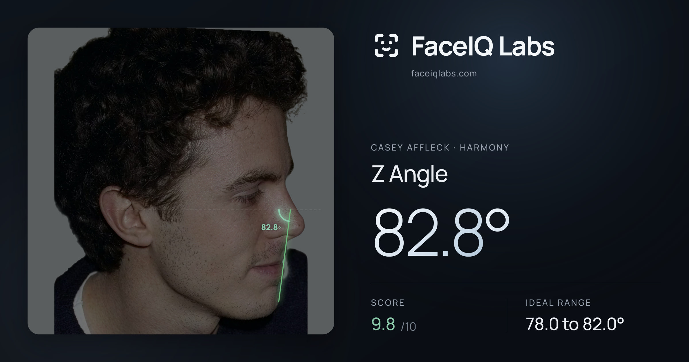 Casey Affleck Z Angle: 82.8°, drawn on the photo