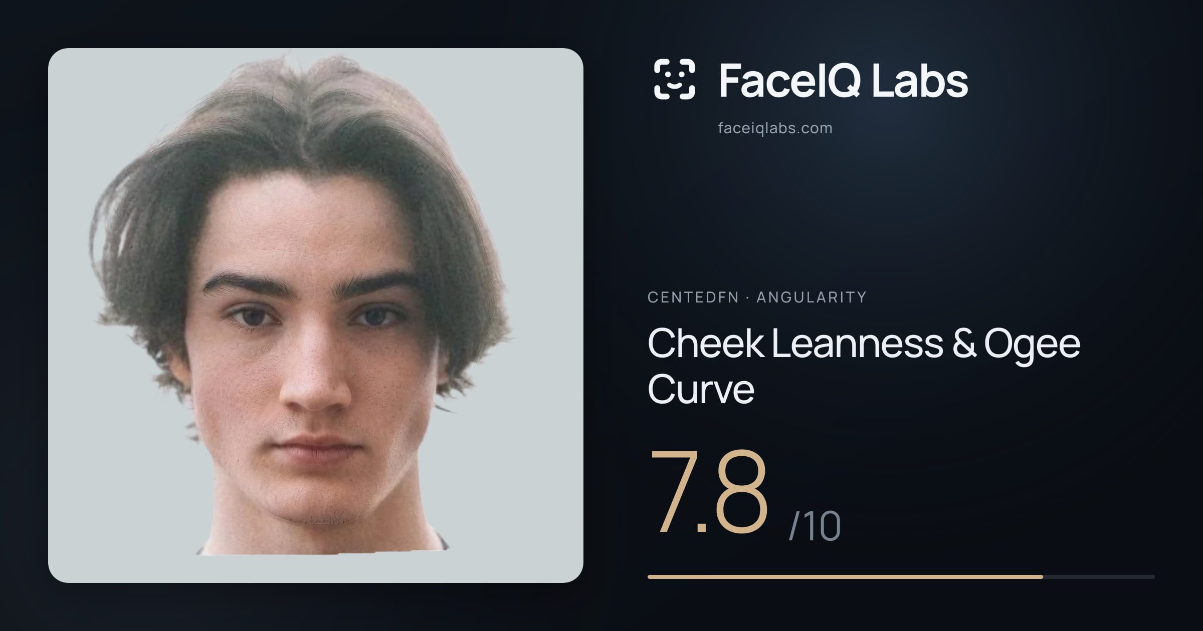 CentedFN Cheek Leanness & Ogee Curve: 7.8/10, drawn on the photo