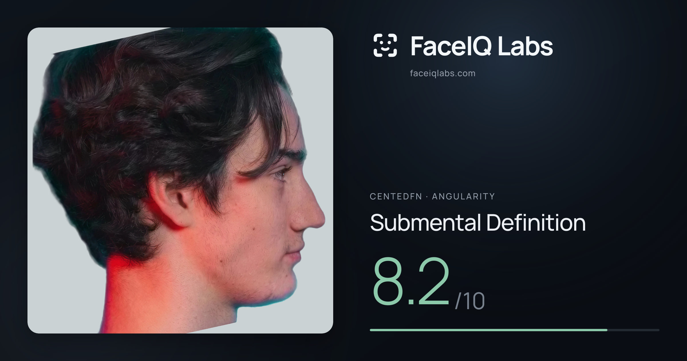 CentedFN Submental Definition: 8.2/10, drawn on the photo