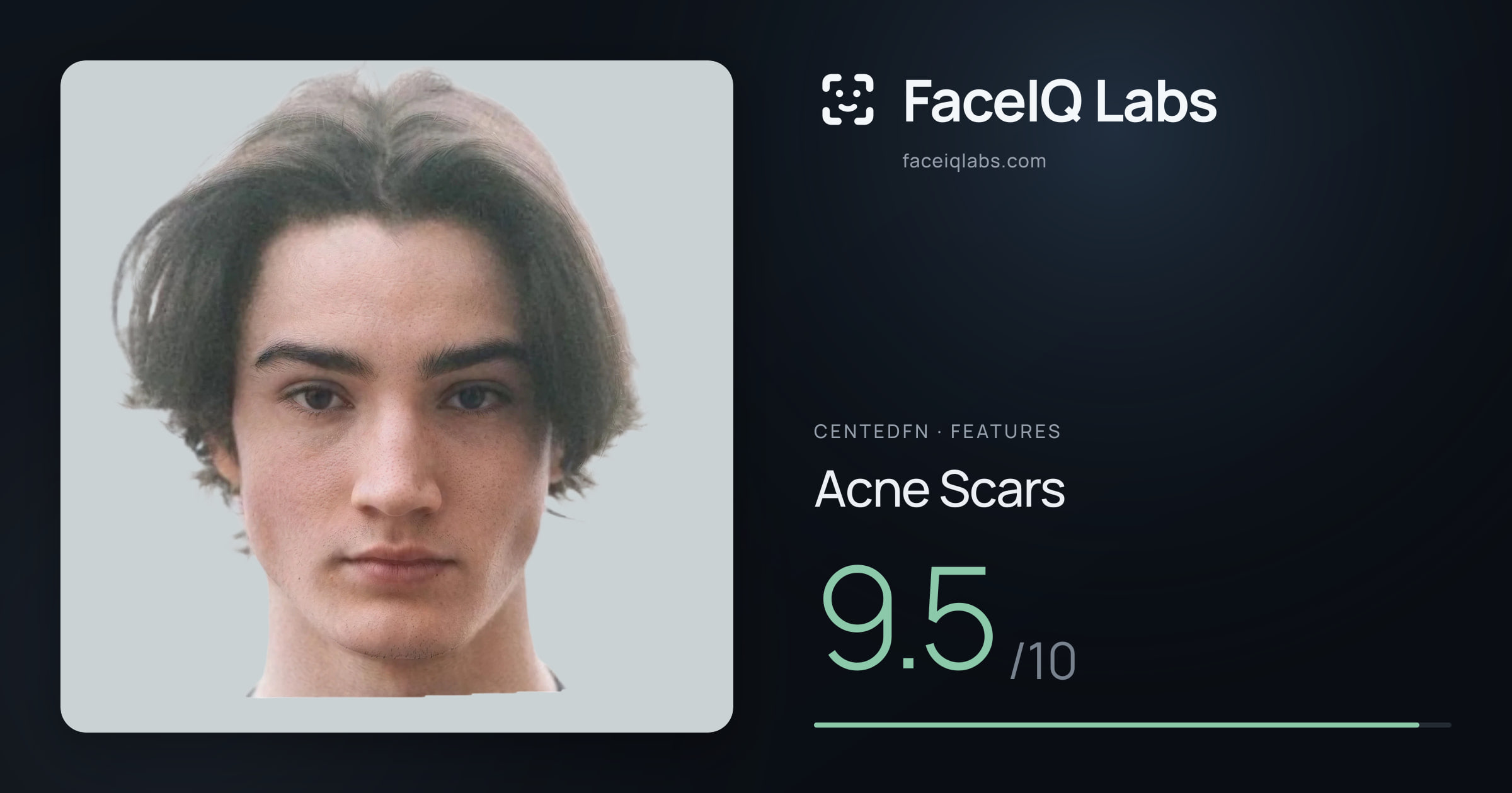 CentedFN Acne Scars: 9.5/10, drawn on the photo
