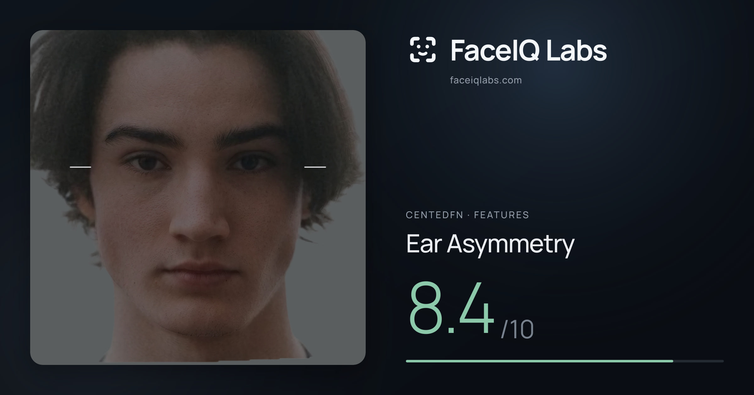 CentedFN Ear Asymmetry: 8.4/10, drawn on the photo