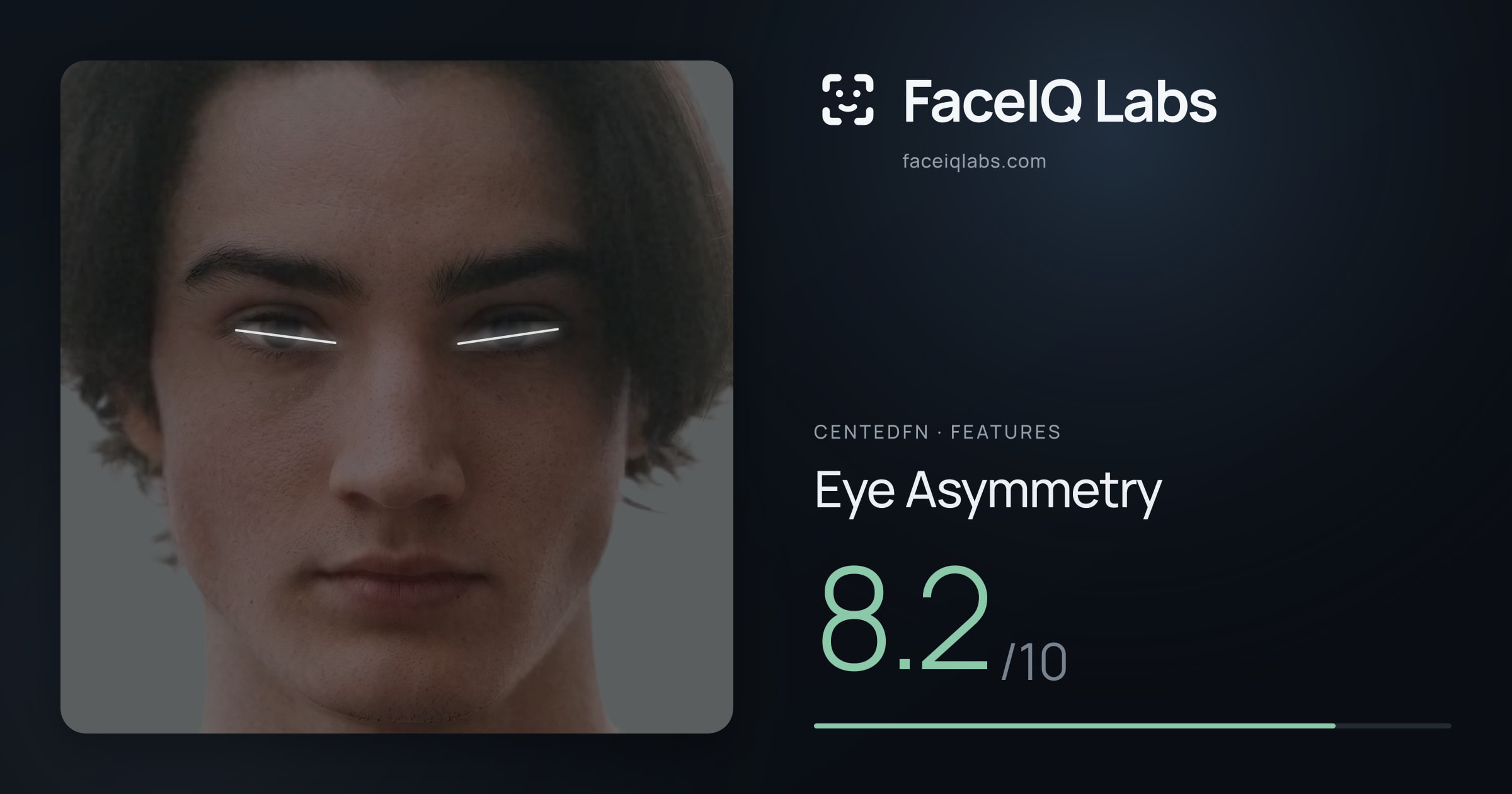 CentedFN Eye Asymmetry: 8.2/10, drawn on the photo