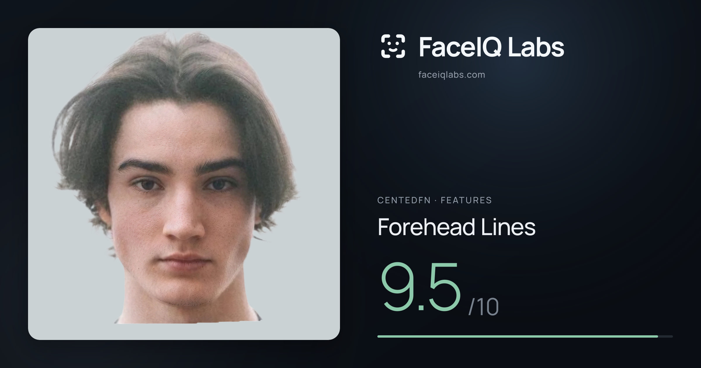 CentedFN Forehead Lines: 9.5/10, drawn on the photo