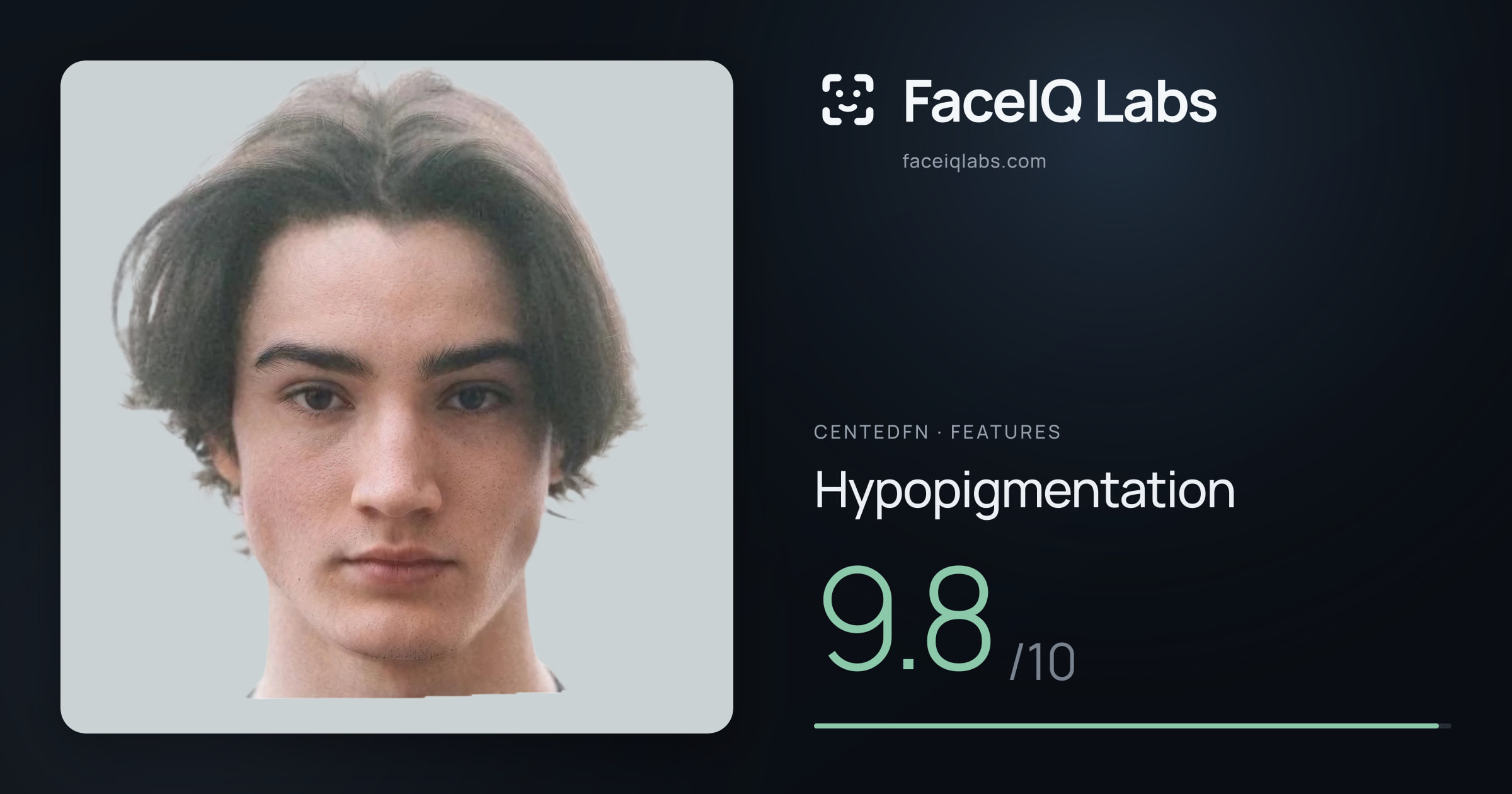 CentedFN Hypopigmentation: 9.8/10, drawn on the photo