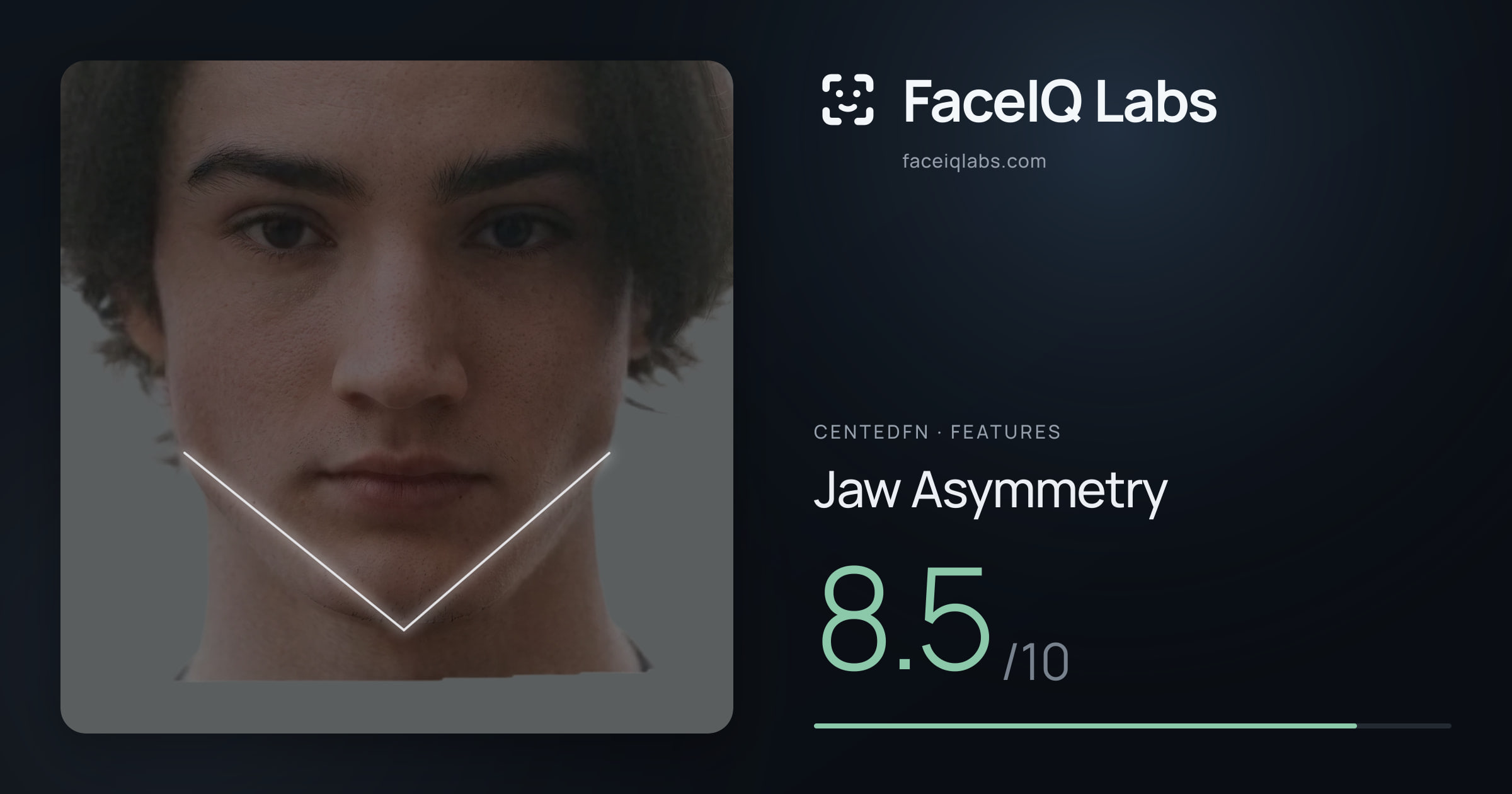 CentedFN Jaw Asymmetry: 8.5/10, drawn on the photo
