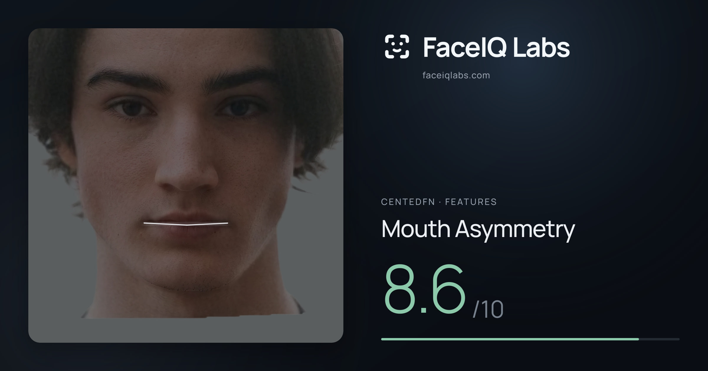 CentedFN Mouth Asymmetry: 8.6/10, drawn on the photo