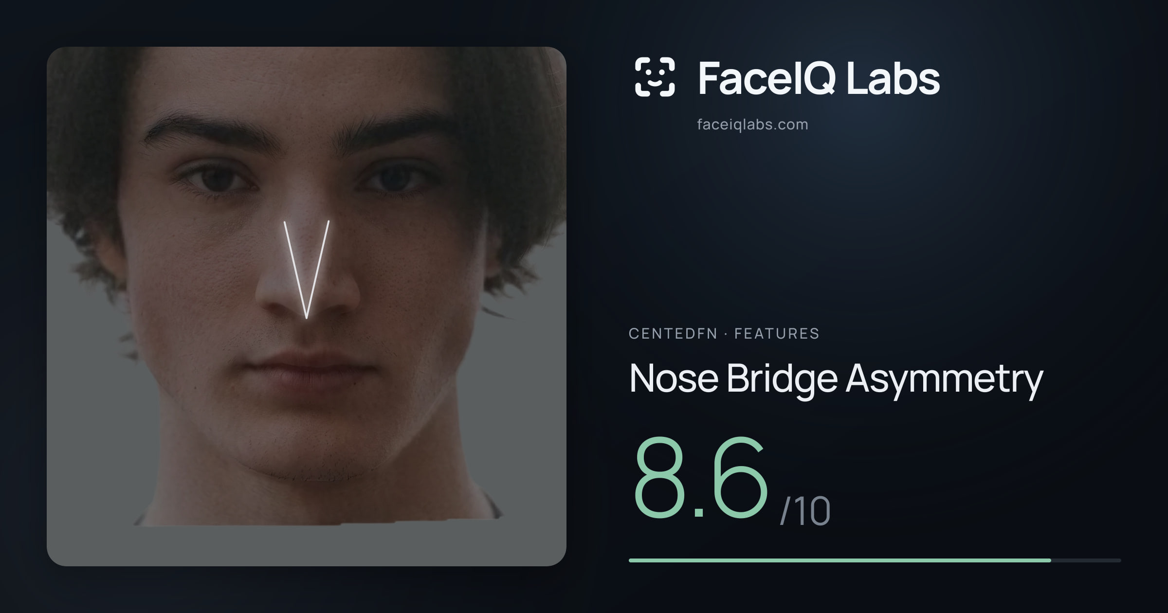 CentedFN Nose Bridge Asymmetry: 8.6/10, drawn on the photo