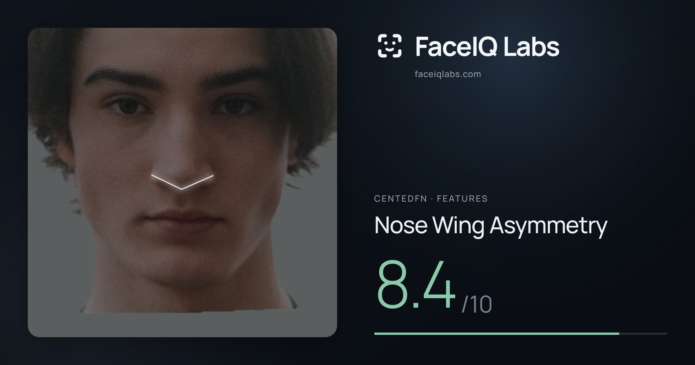 CentedFN Nose Wing Asymmetry: 8.4/10, drawn on the photo