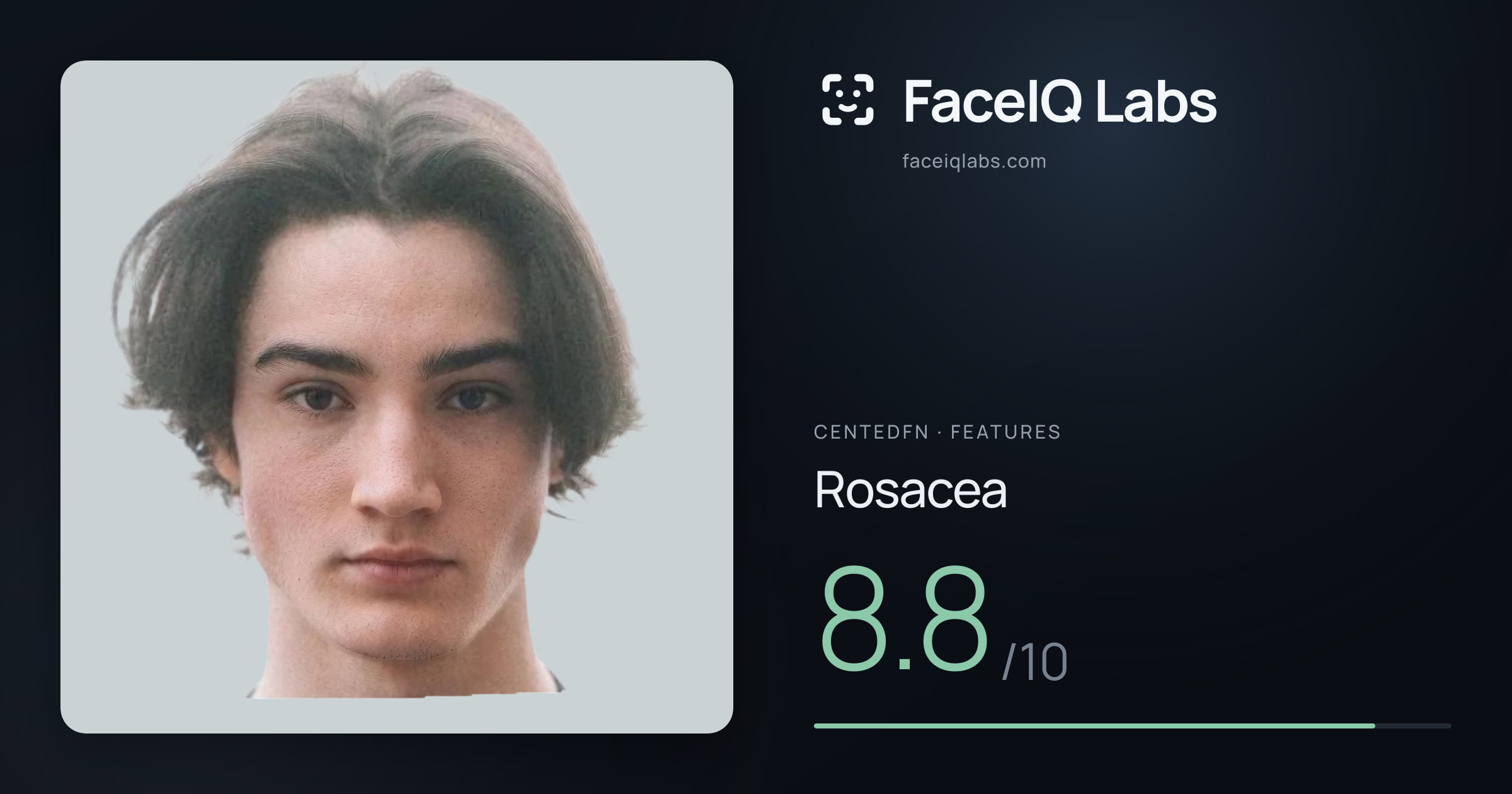 CentedFN Rosacea: 8.8/10, drawn on the photo