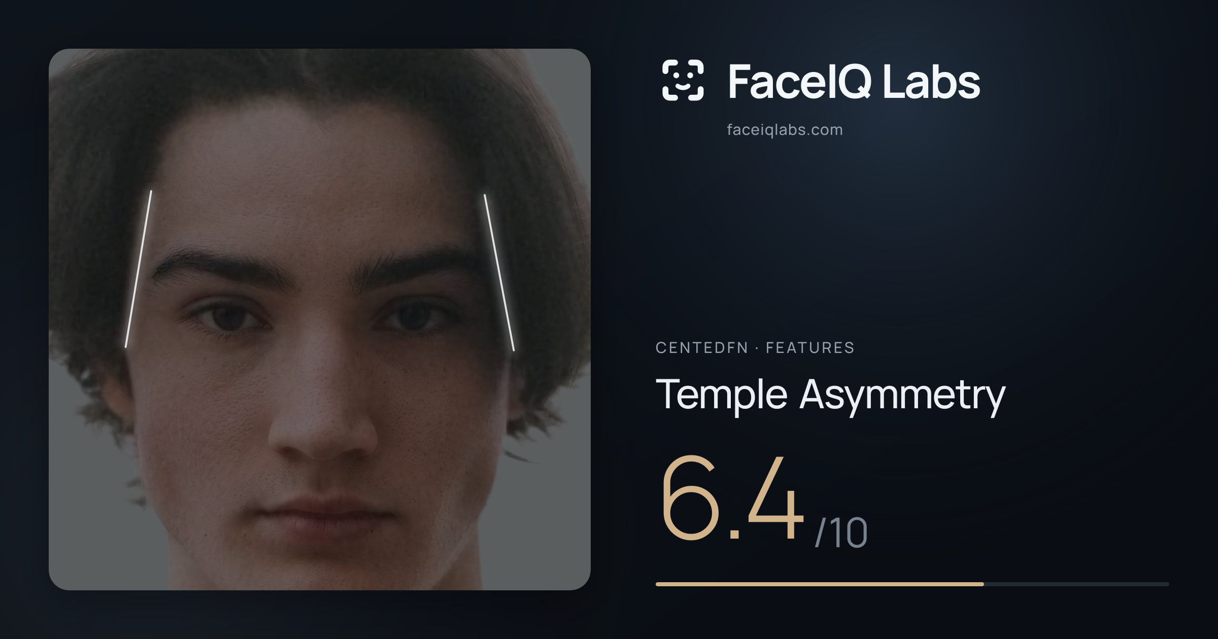 CentedFN Temple Asymmetry: 6.4/10, drawn on the photo