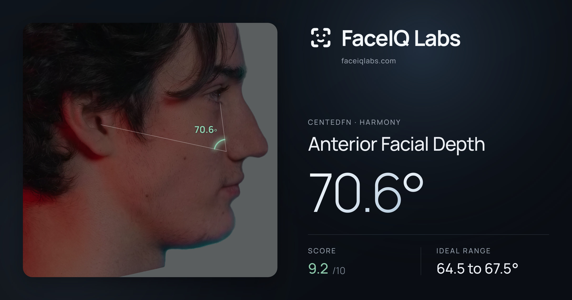 CentedFN Anterior Facial Depth: 70.6°, drawn on the photo