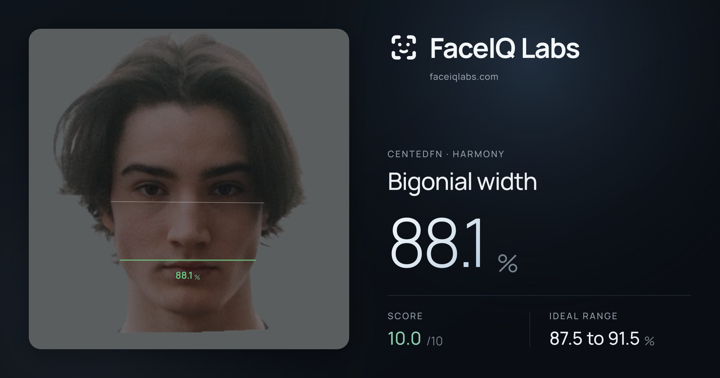 CentedFN Bigonial width: 88.1%, drawn on the photo
