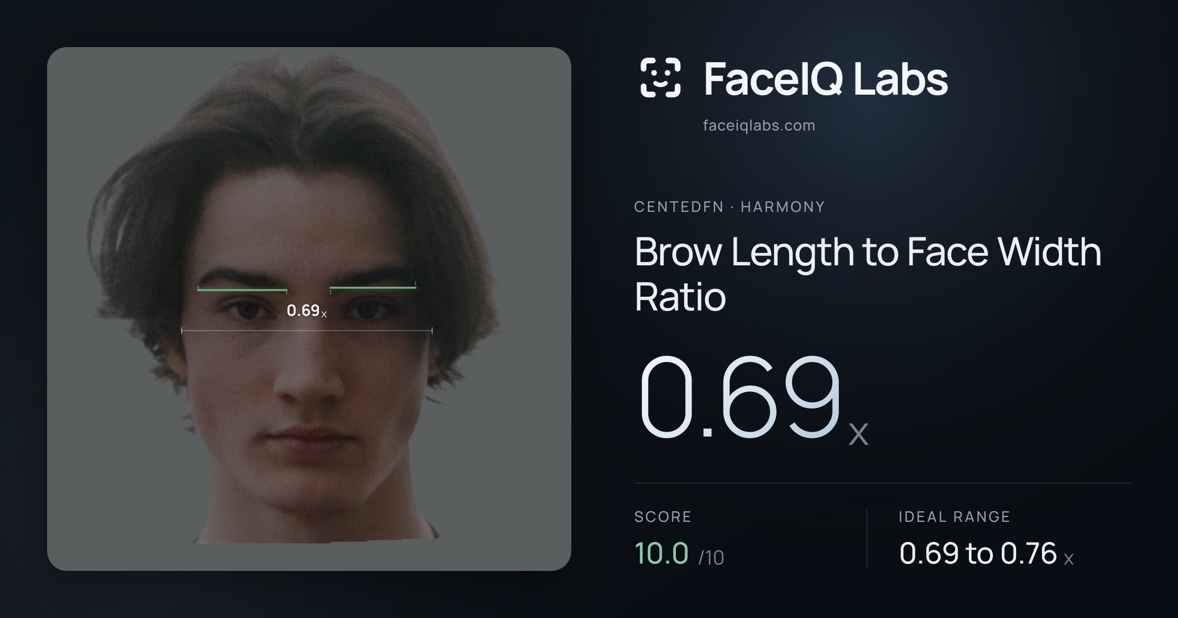 CentedFN Brow Length to Face Width Ratio: 0.69x, drawn on the photo