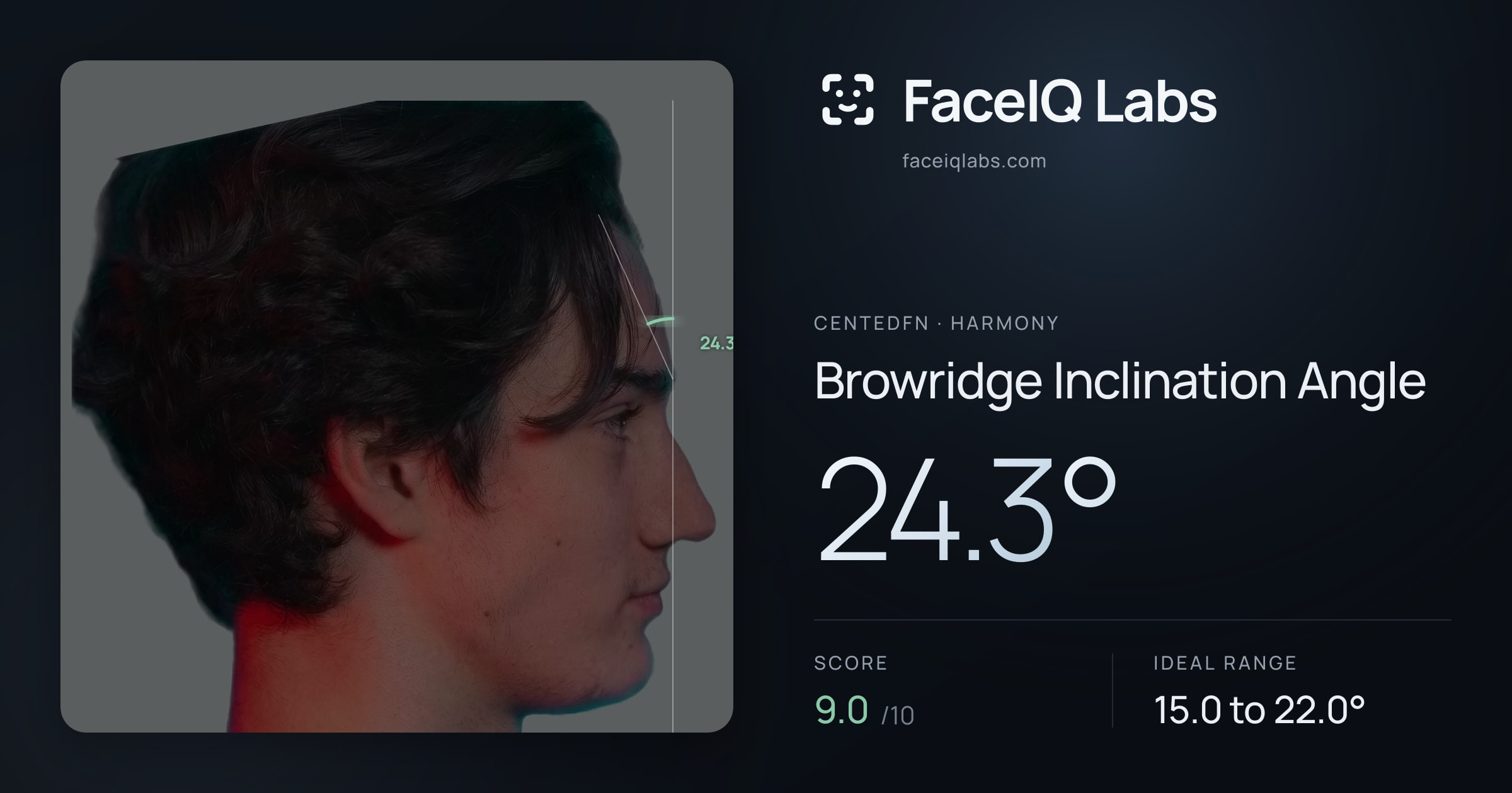 CentedFN Browridge Inclination Angle: 24.3°, drawn on the photo