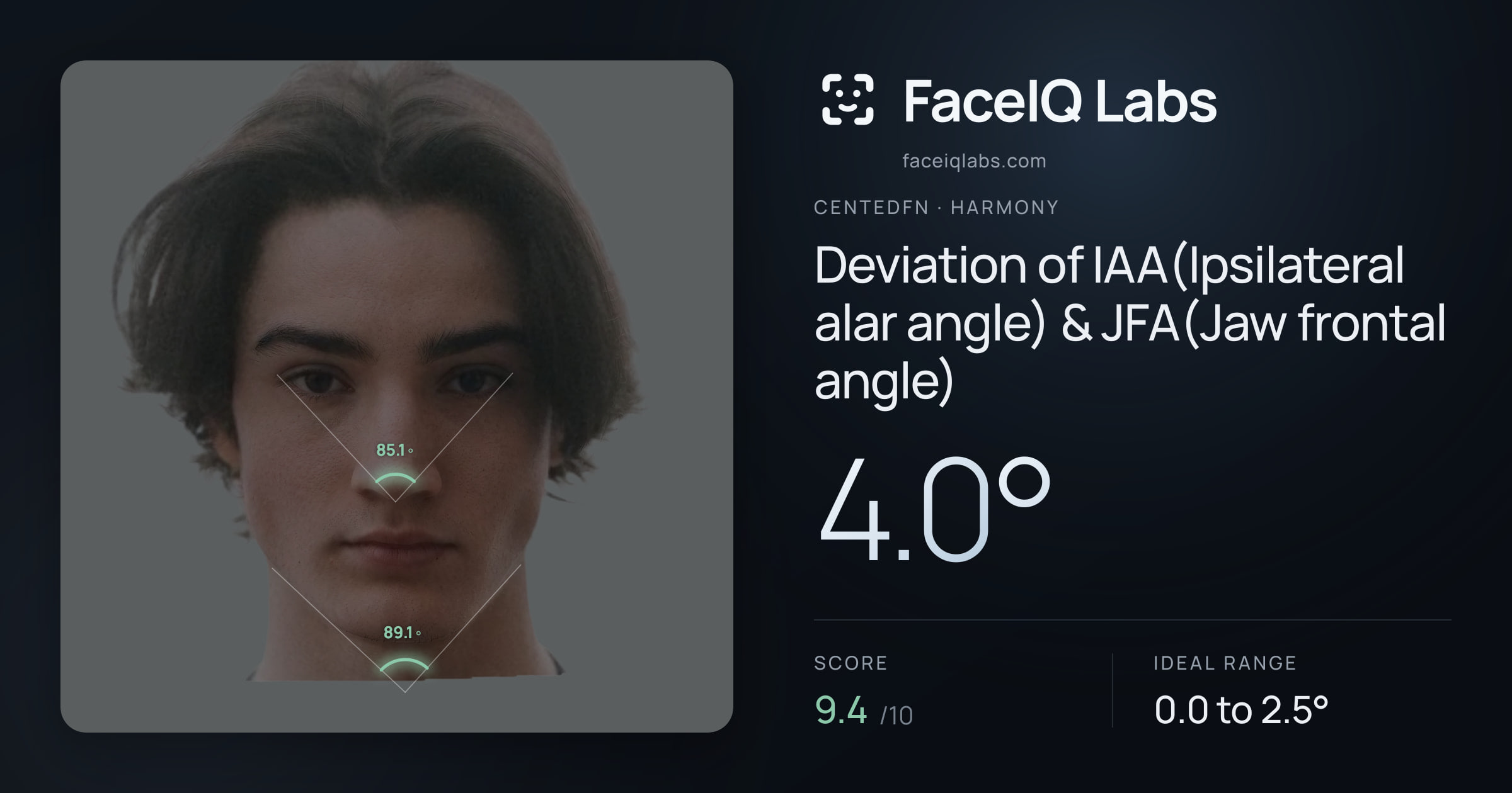 CentedFN Deviation of IAA(Ipsilateral alar angle) & JFA(Jaw frontal angle): 4.0°, drawn on the photo