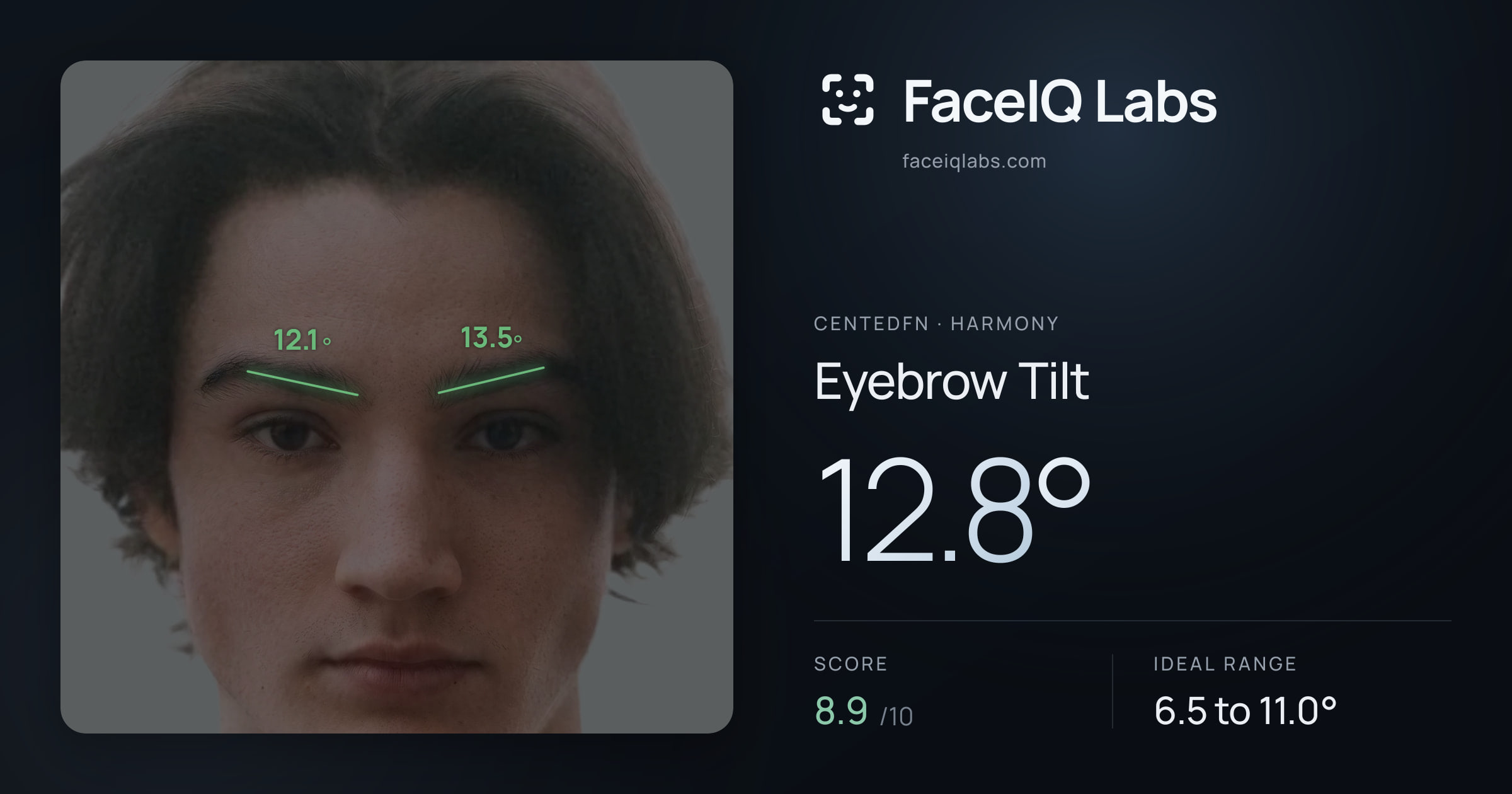 CentedFN Eyebrow Tilt: 12.8°, drawn on the photo