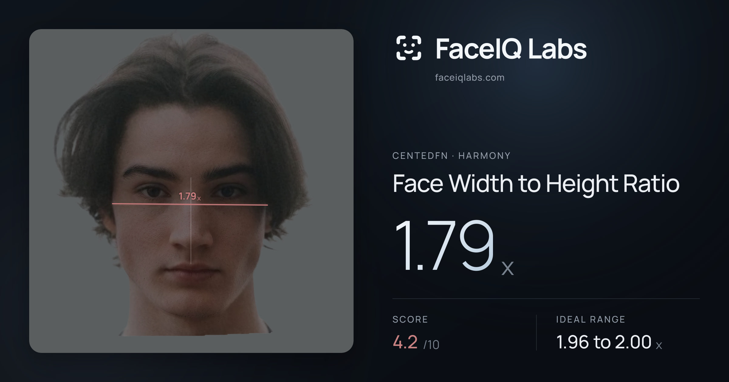 CentedFN Face Width to Height Ratio: 1.79x, drawn on the photo