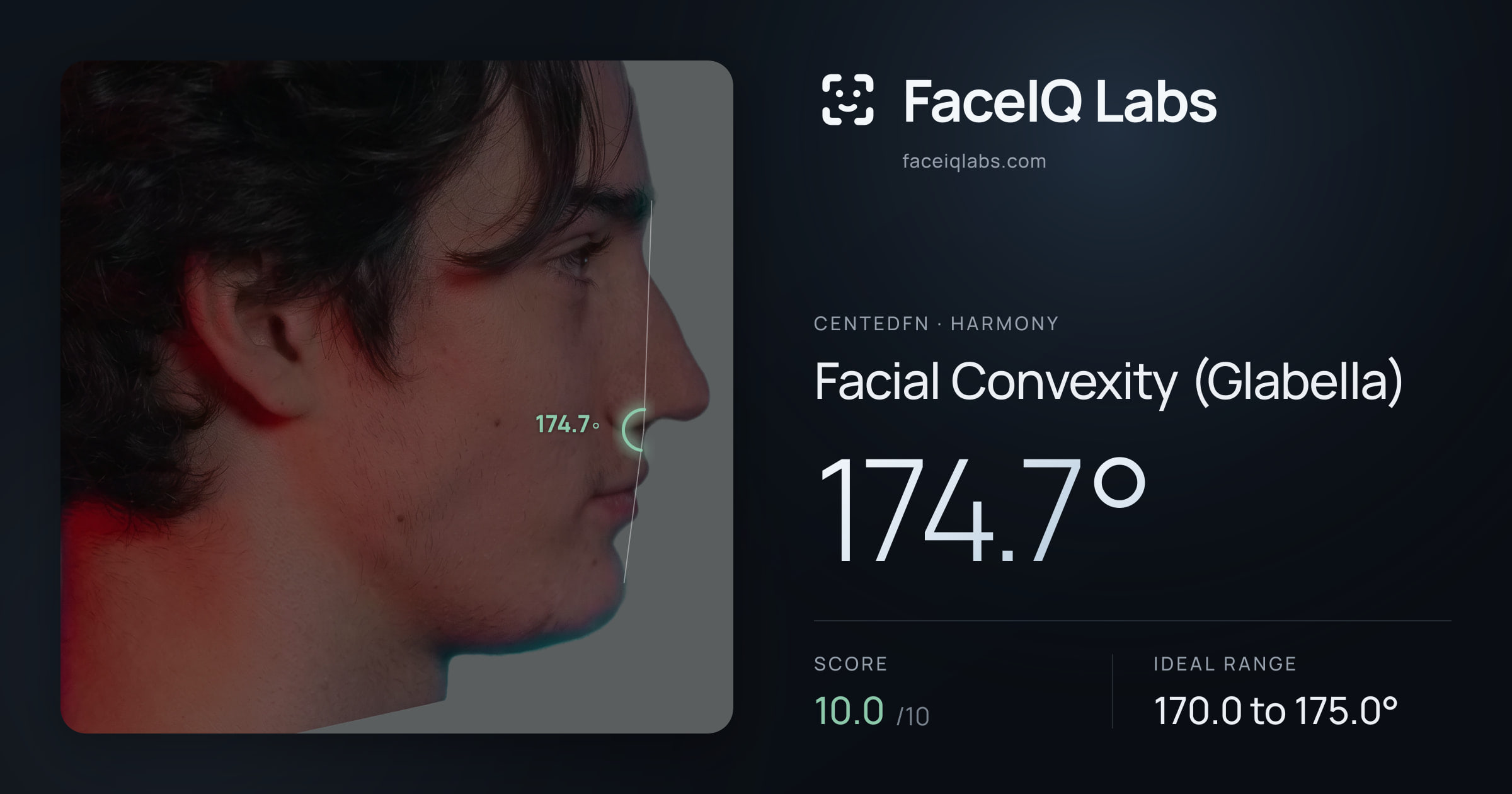 CentedFN Facial Convexity (Glabella): 174.7°, drawn on the photo