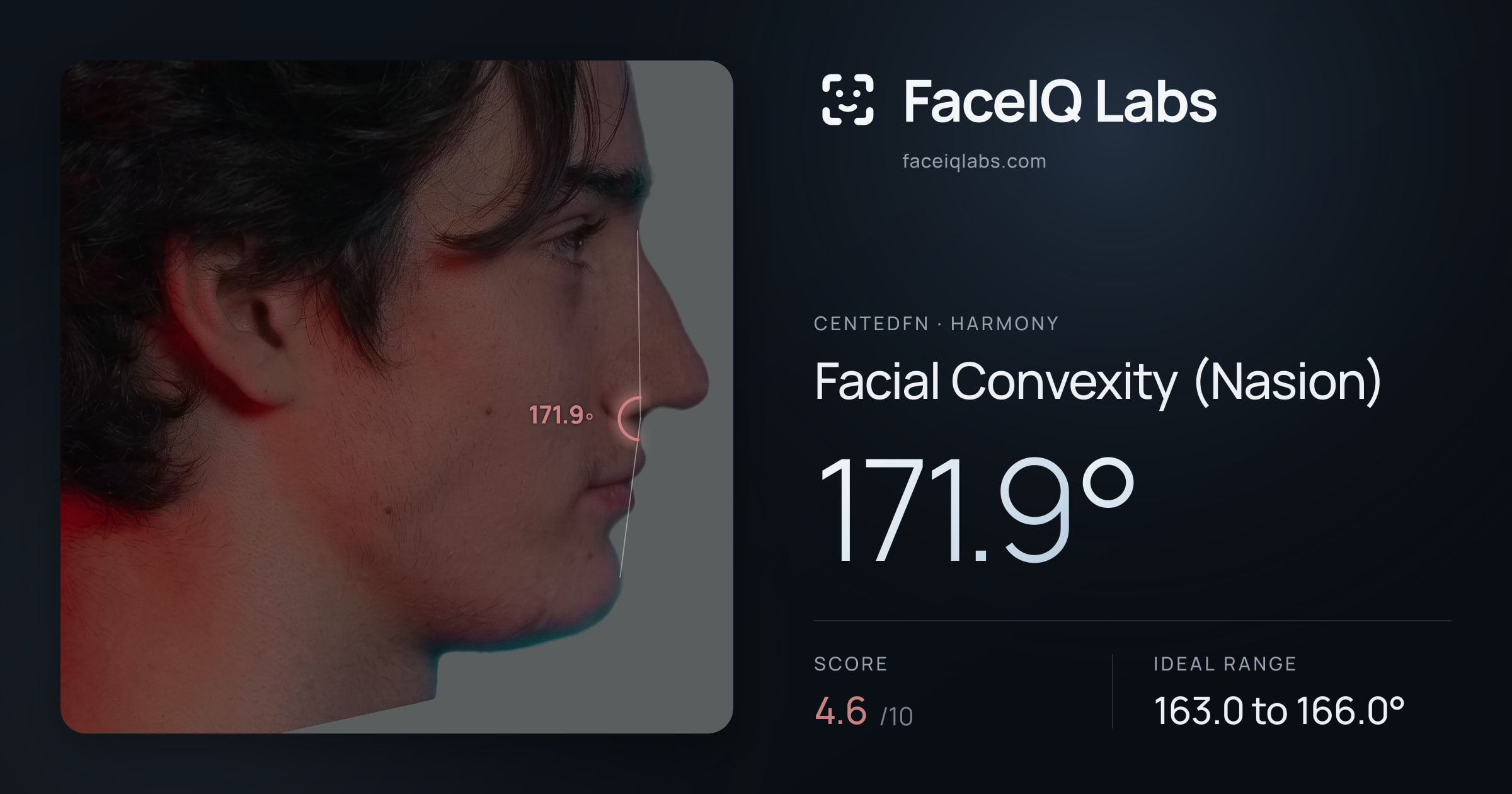 CentedFN Facial Convexity (Nasion): 171.9°, drawn on the photo