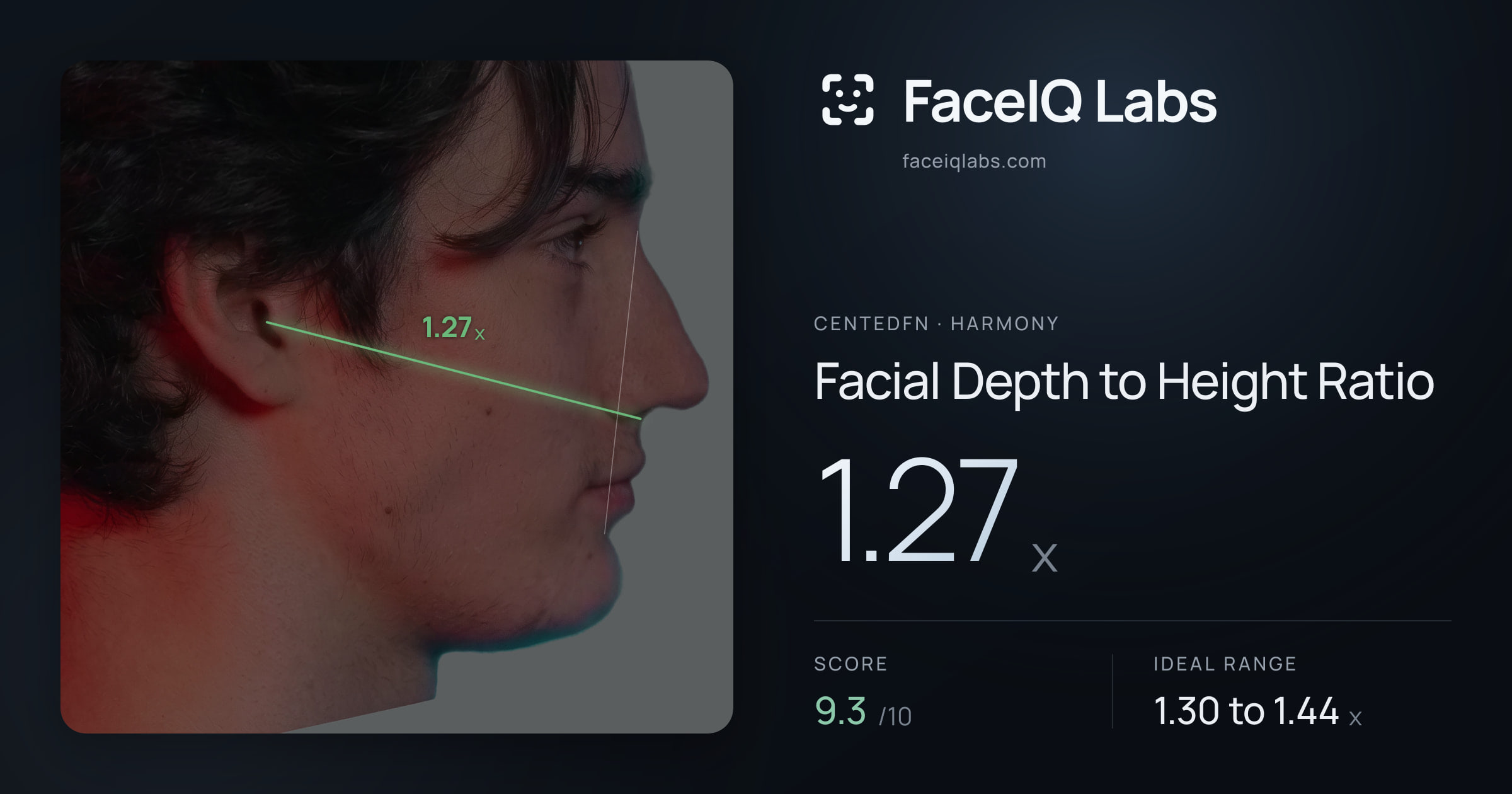 CentedFN Facial Depth to Height Ratio: 1.27x, drawn on the photo