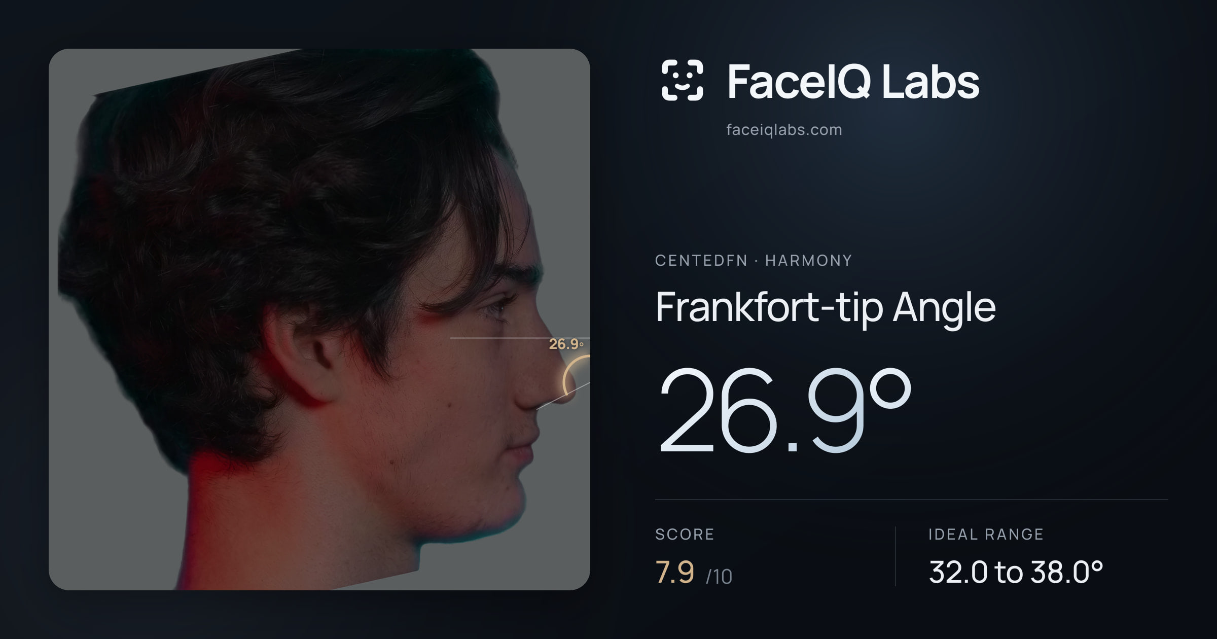 CentedFN Frankfort-tip Angle: 26.9°, drawn on the photo