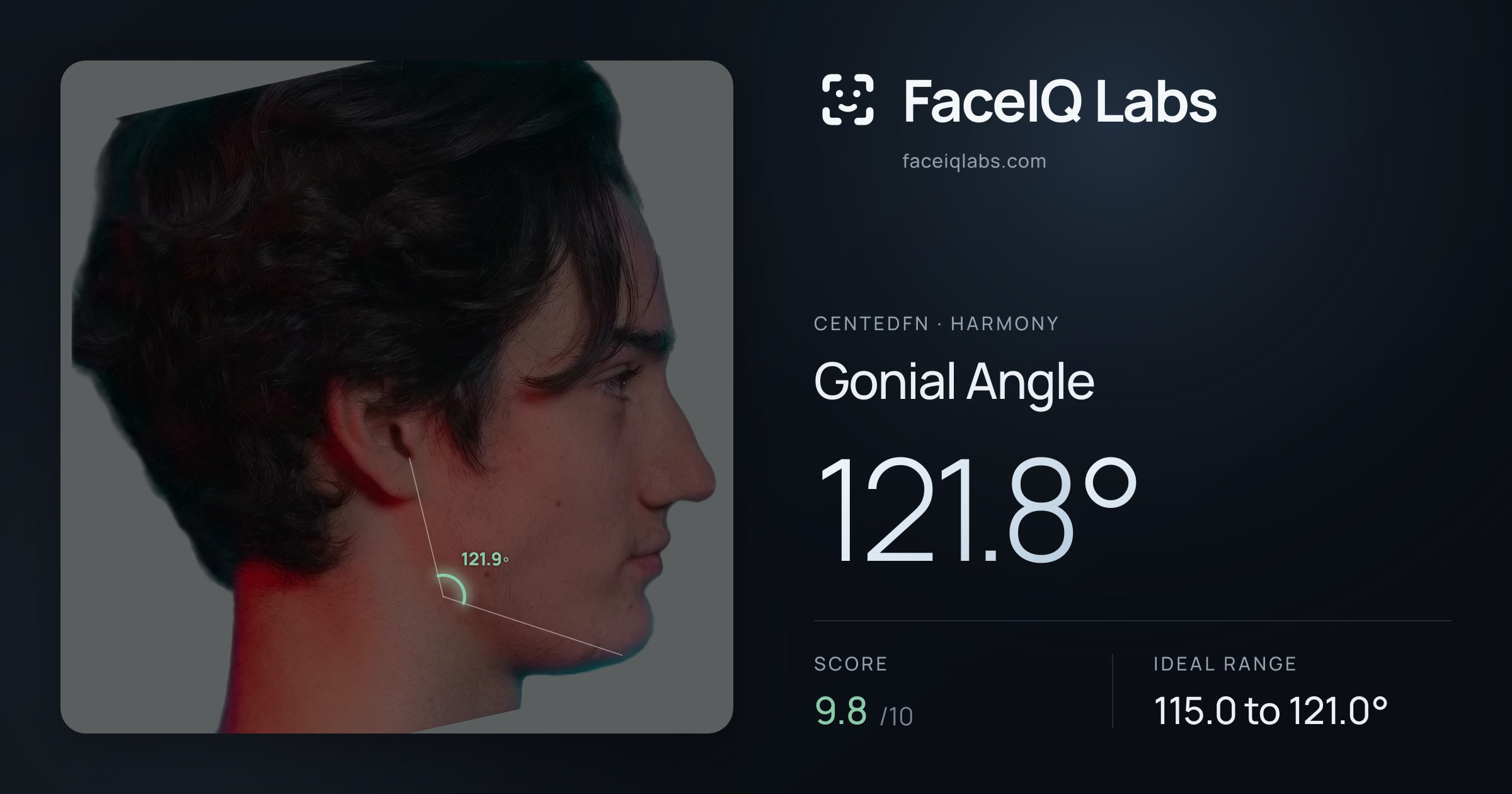 CentedFN Gonial Angle: 121.8°, drawn on the photo