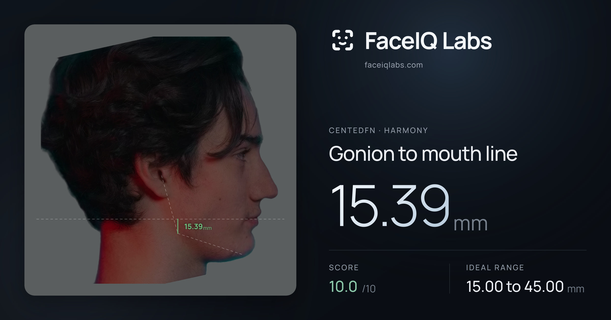 CentedFN Gonion to mouth line: 15.39mm, drawn on the photo
