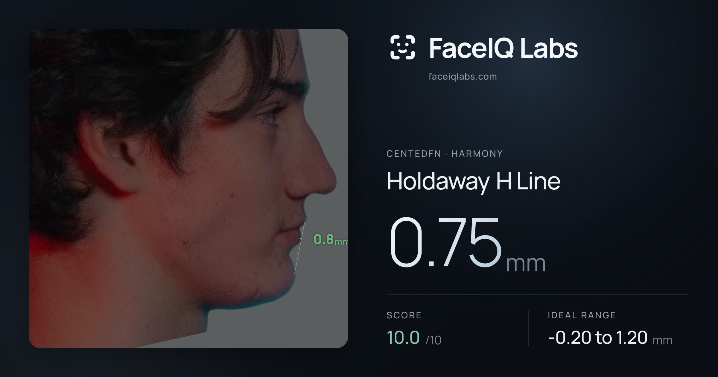 CentedFN Holdaway H Line: 0.75mm, drawn on the photo