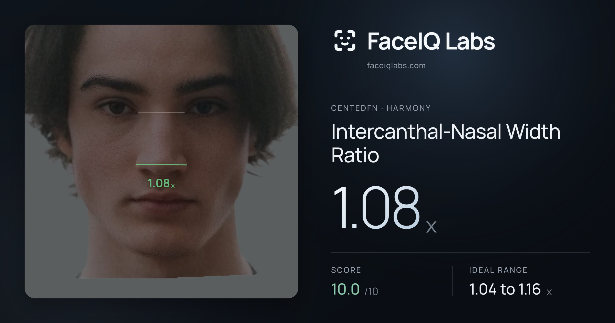 CentedFN Intercanthal-Nasal Width Ratio: 1.08x, drawn on the photo