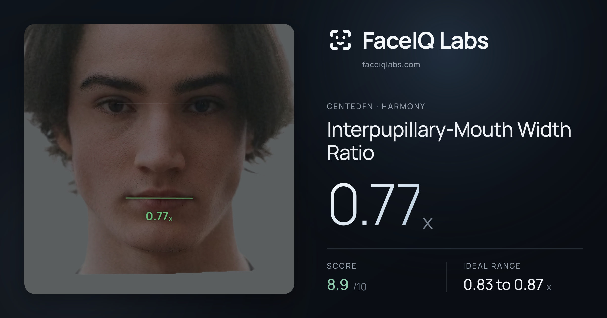 CentedFN Interpupillary-Mouth Width Ratio: 0.77x, drawn on the photo