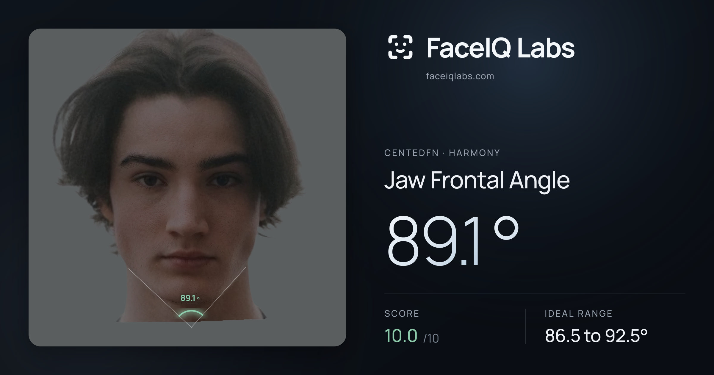 CentedFN Jaw Frontal Angle: 89.1°, drawn on the photo
