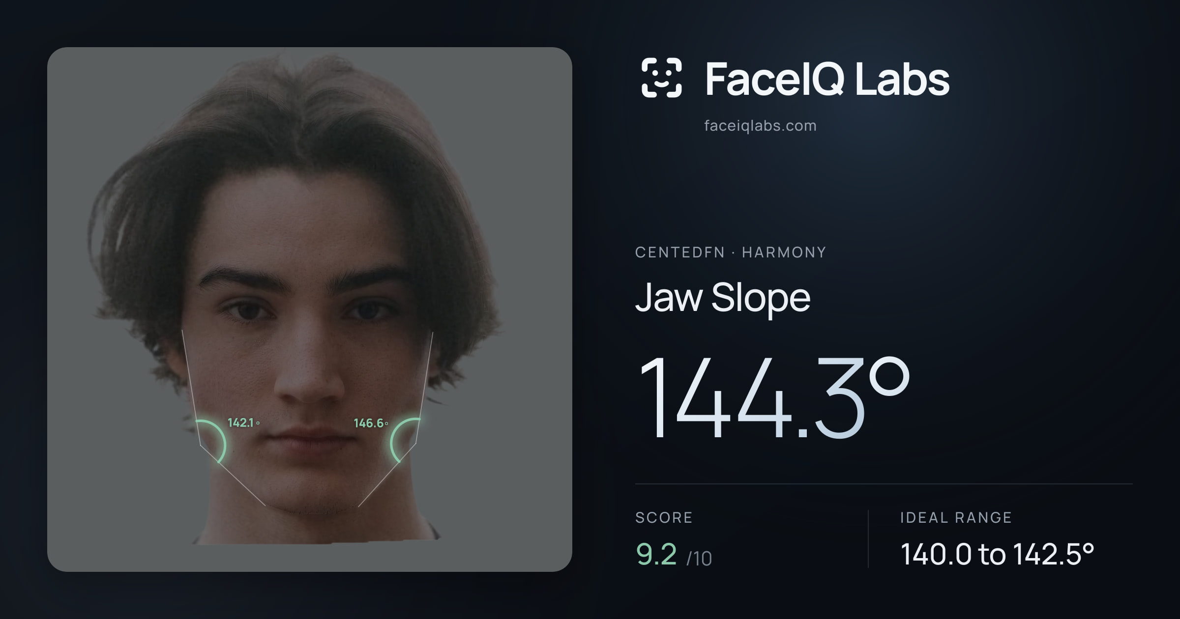 CentedFN Jaw Slope: 144.3°, drawn on the photo