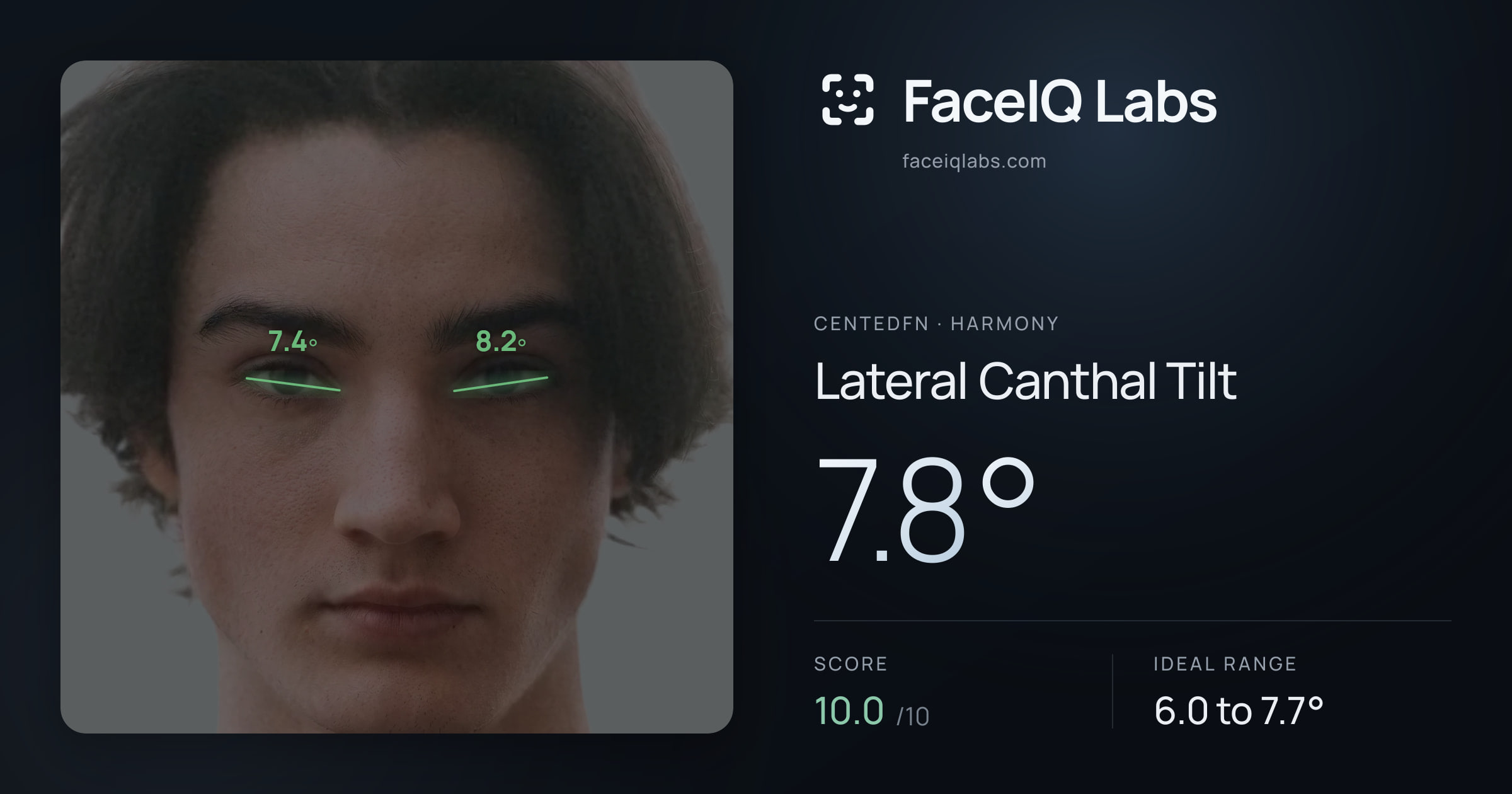 CentedFN Lateral Canthal Tilt: 7.8°, drawn on the photo