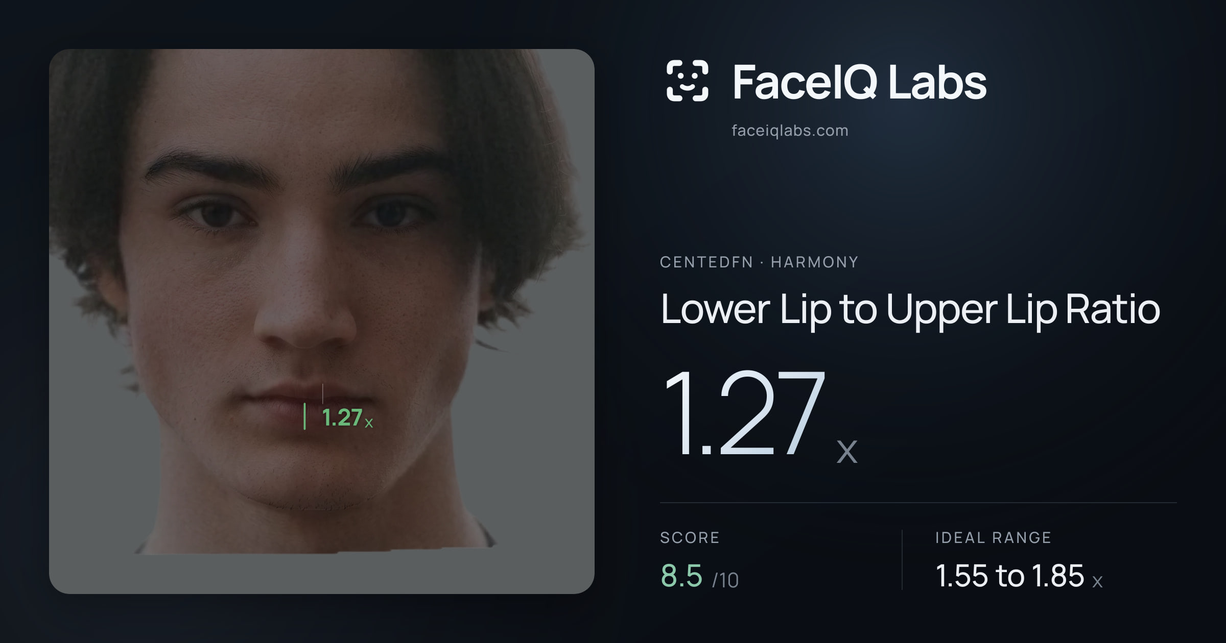 CentedFN Lower Lip to Upper Lip Ratio: 1.27x, drawn on the photo