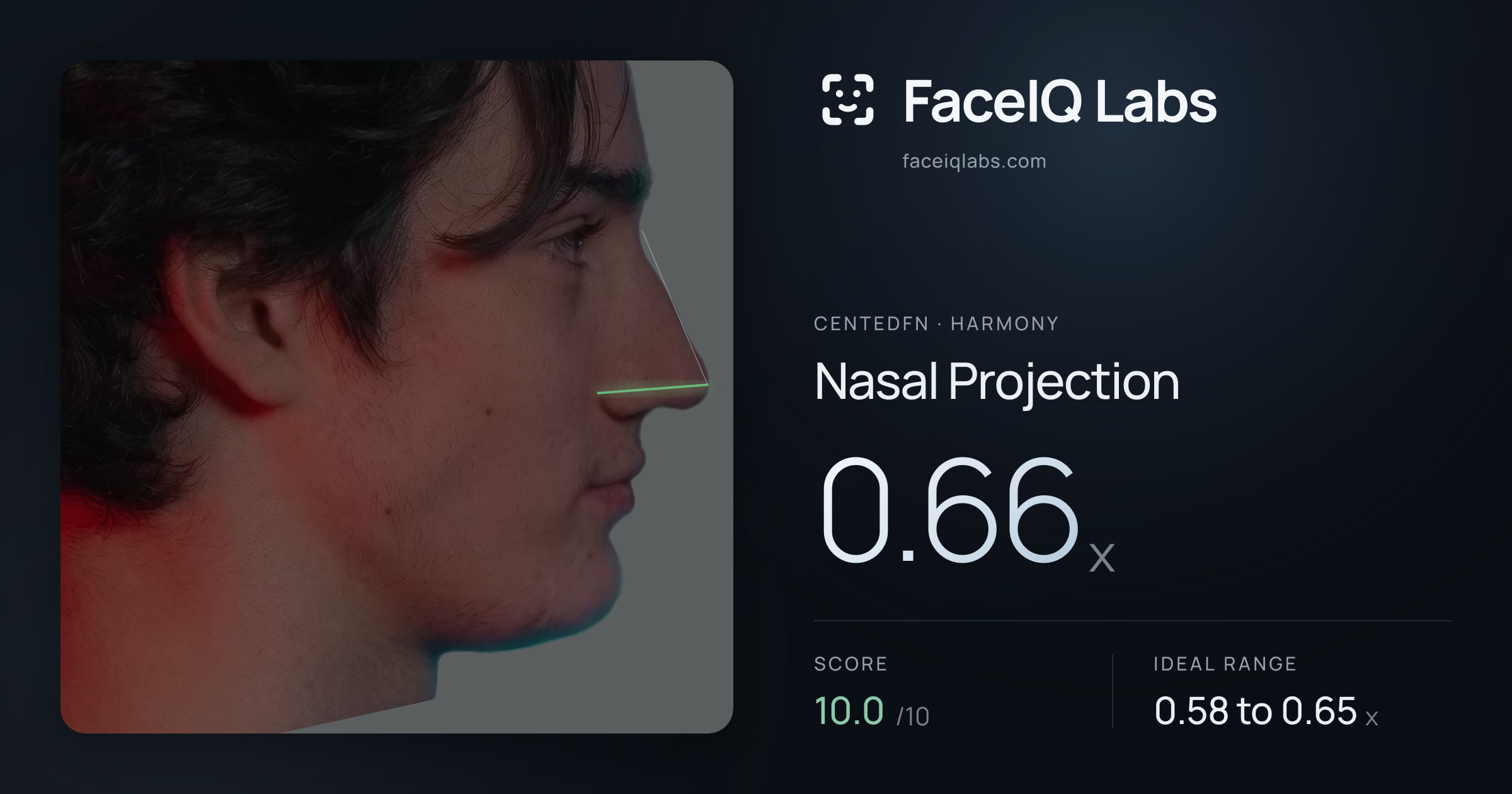 CentedFN Nasal Projection: 0.66x, drawn on the photo