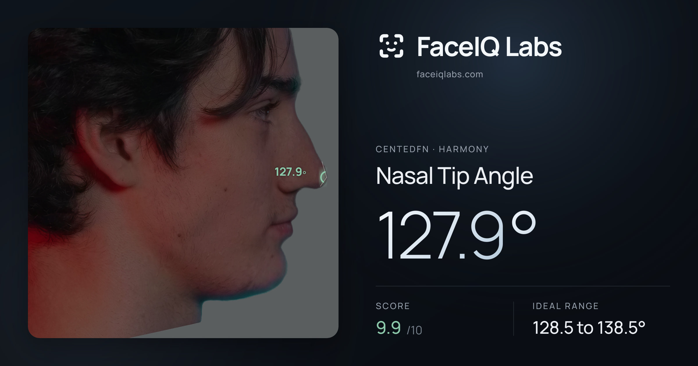 CentedFN Nasal Tip Angle: 127.9°, drawn on the photo