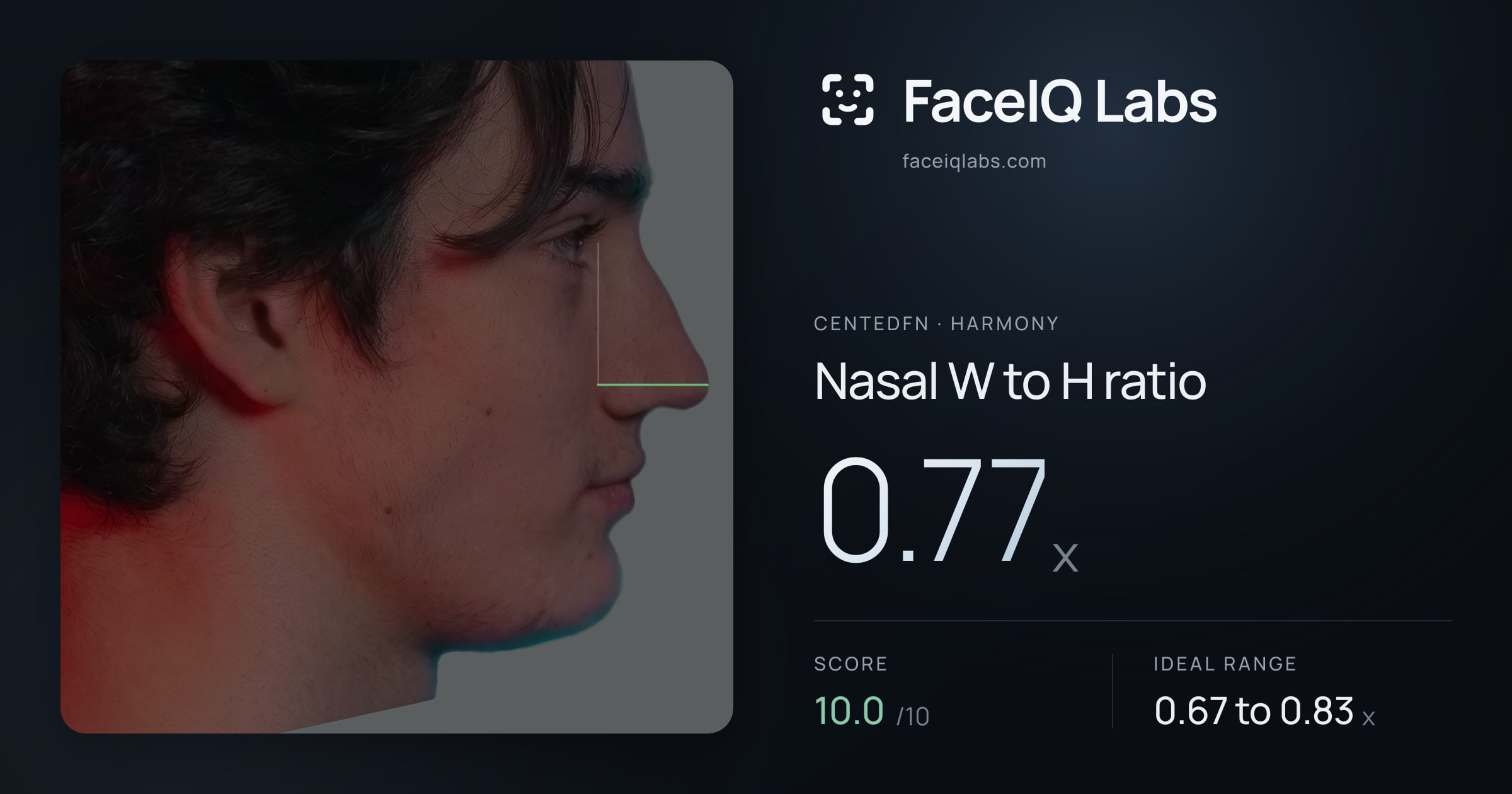CentedFN Nasal W to H ratio: 0.77x, drawn on the photo