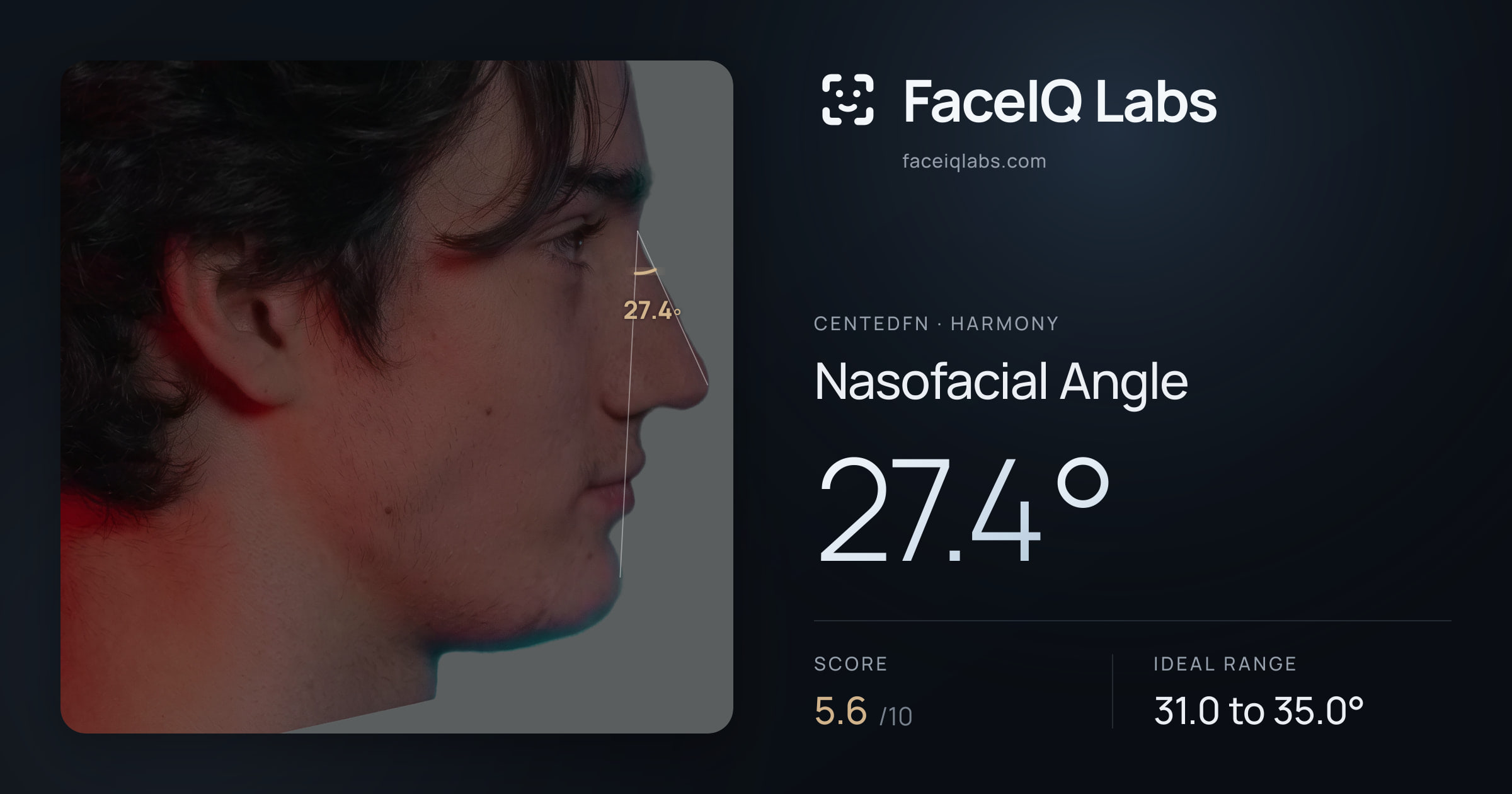 CentedFN Nasofacial Angle: 27.4°, drawn on the photo