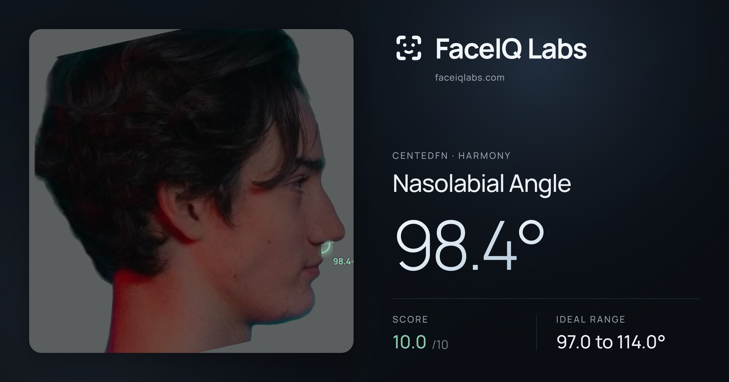 CentedFN Nasolabial Angle: 98.4°, drawn on the photo