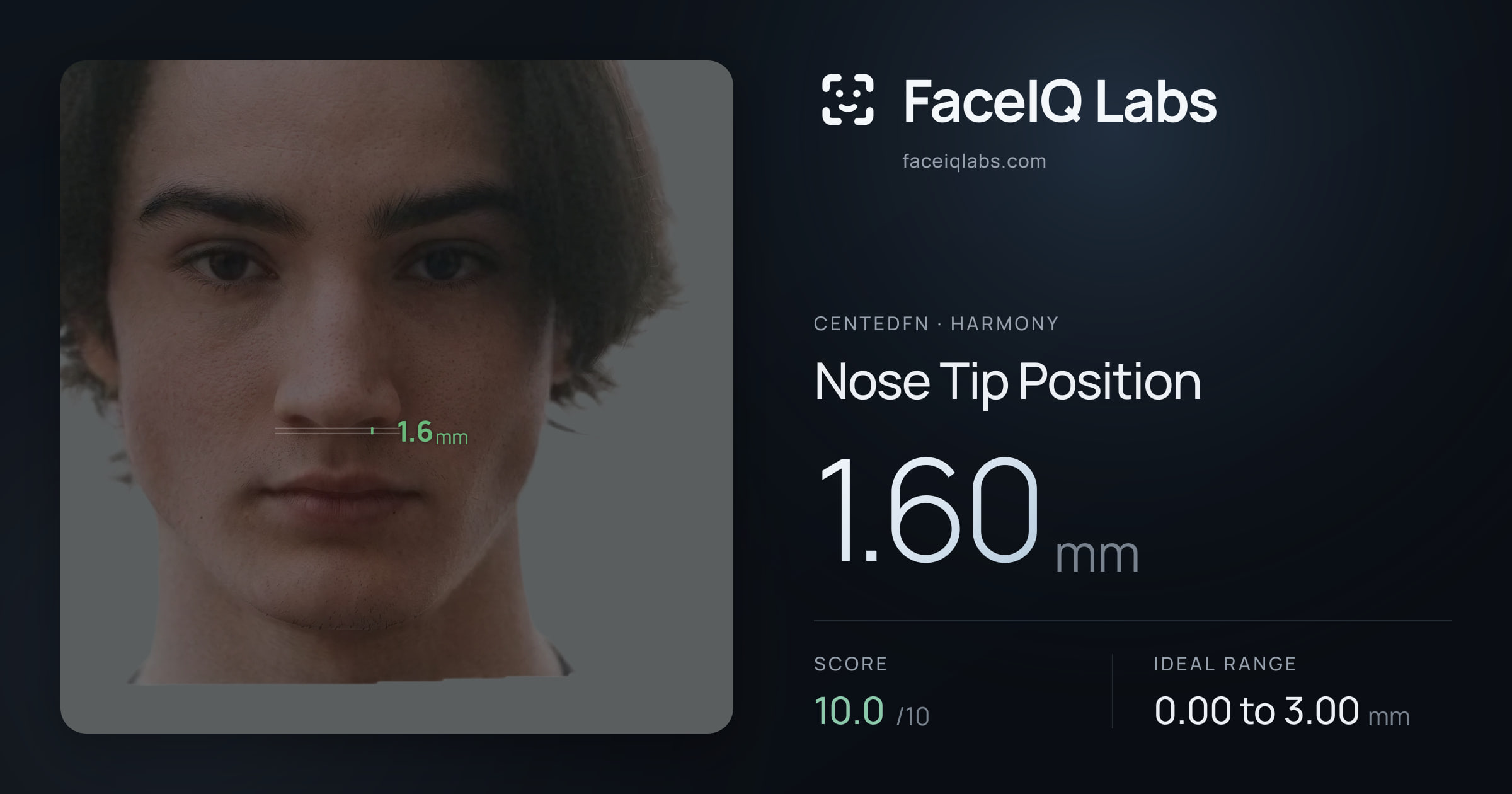 CentedFN Nose Tip Position: 1.60mm, drawn on the photo