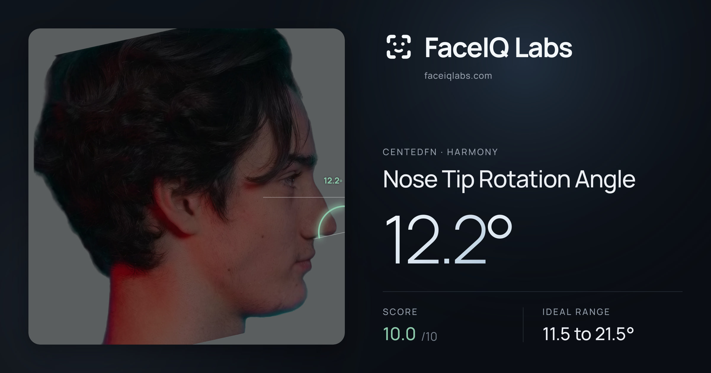 CentedFN Nose Tip Rotation Angle: 12.2°, drawn on the photo