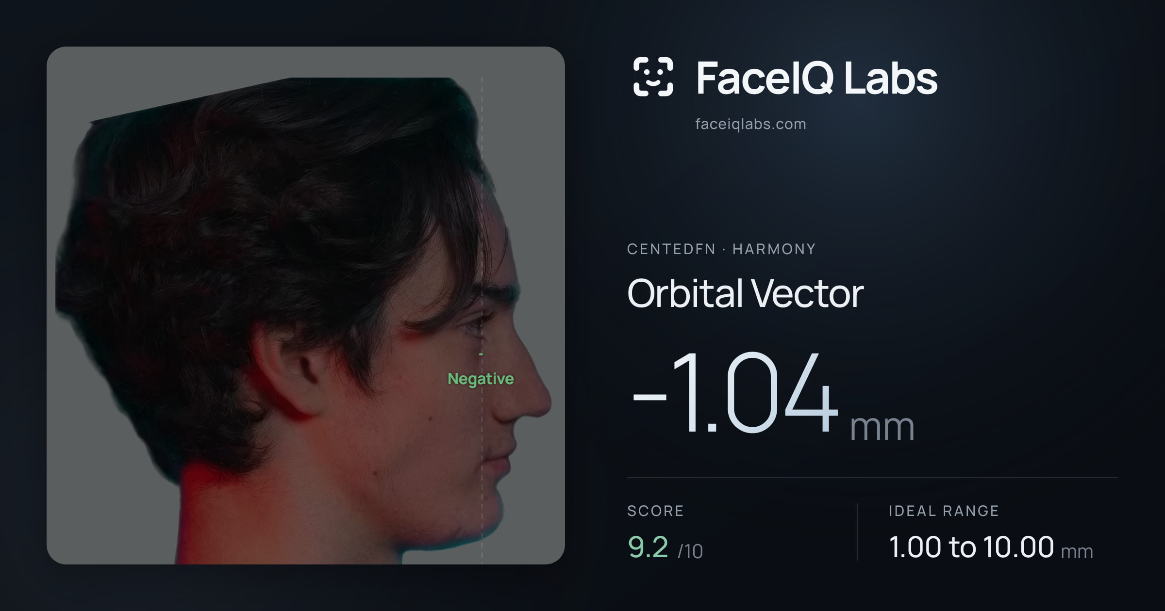 CentedFN Orbital Vector: -1.04mm, drawn on the photo