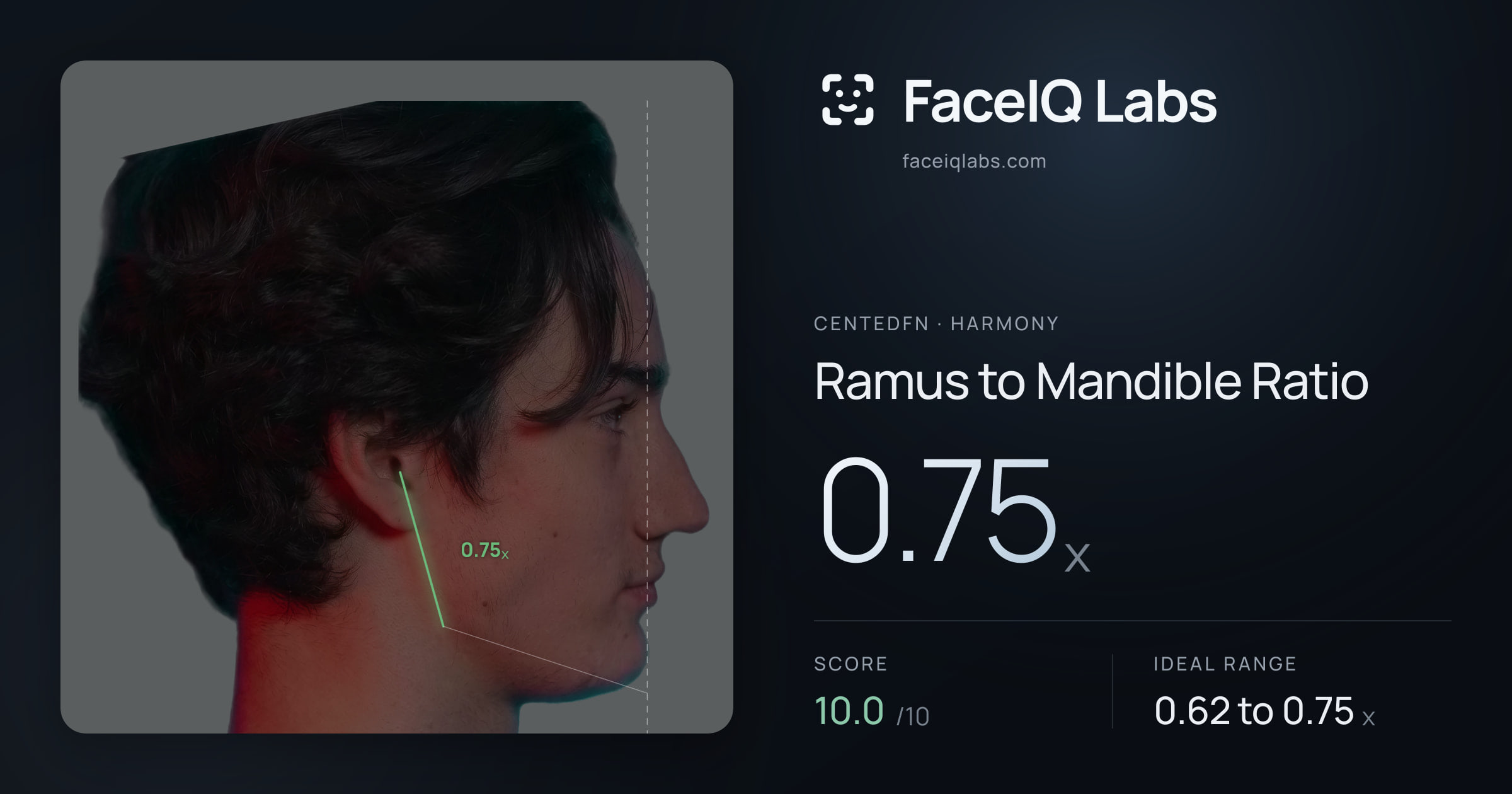 CentedFN Ramus to Mandible Ratio: 0.75x, drawn on the photo