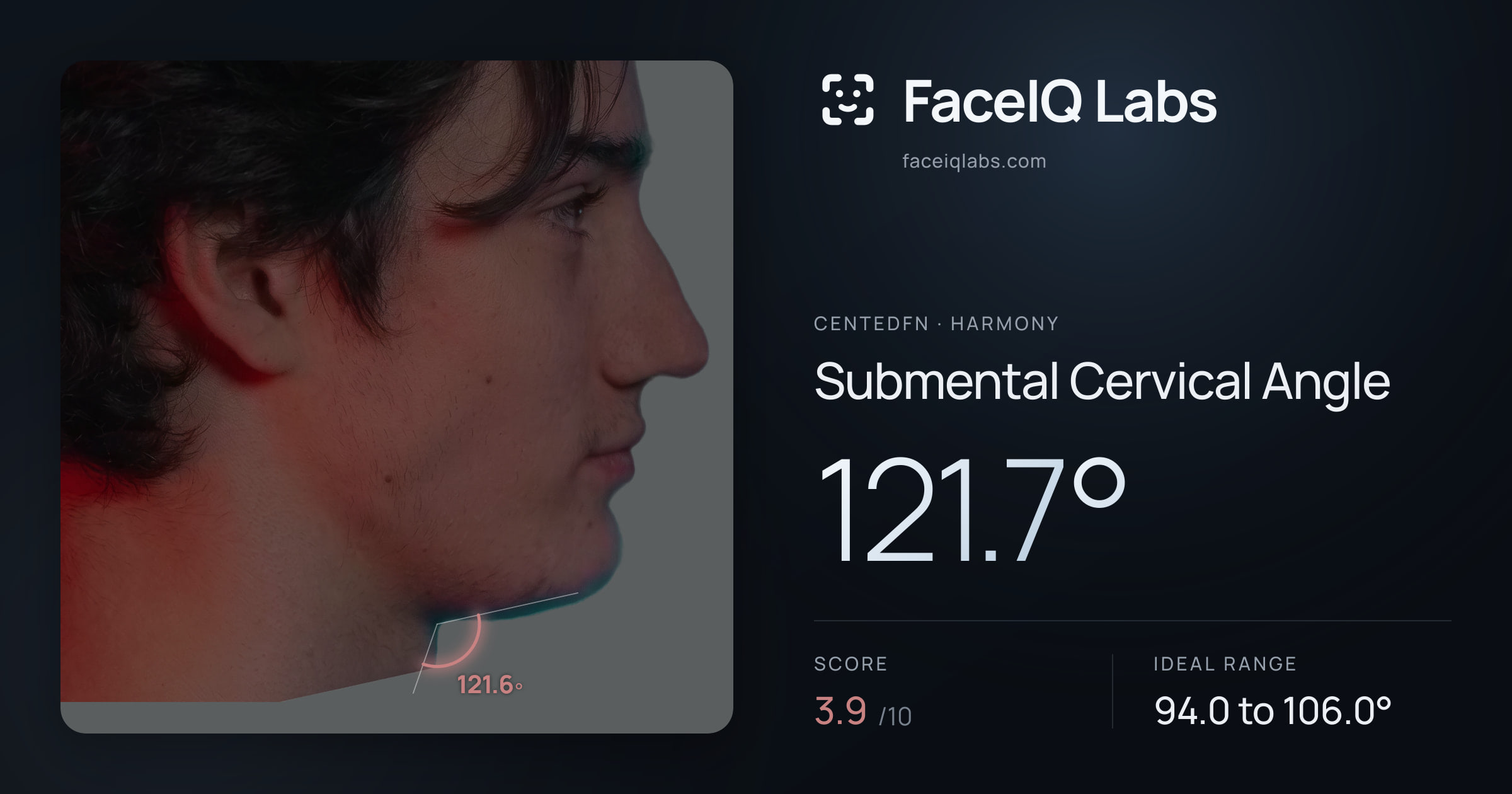 CentedFN Submental Cervical Angle: 121.7°, drawn on the photo