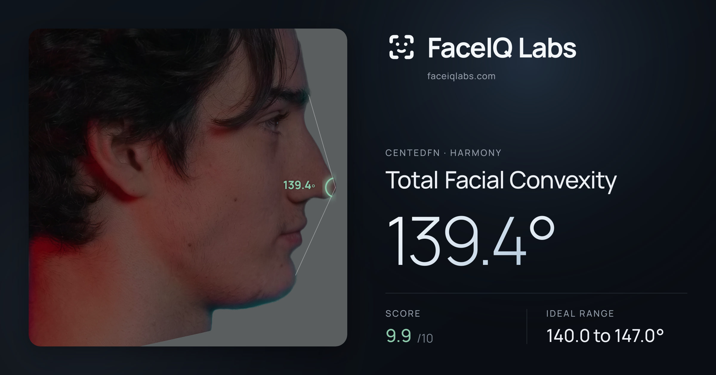 CentedFN Total Facial Convexity: 139.4°, drawn on the photo