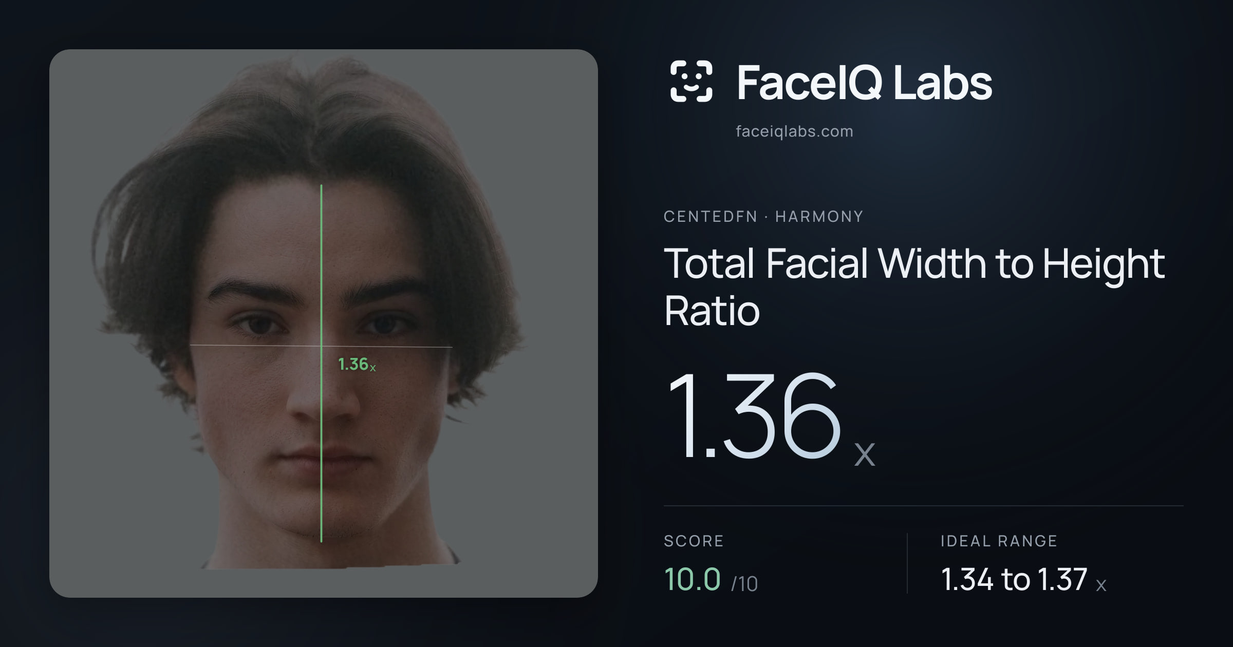CentedFN Total Facial Width to Height Ratio: 1.36x, drawn on the photo
