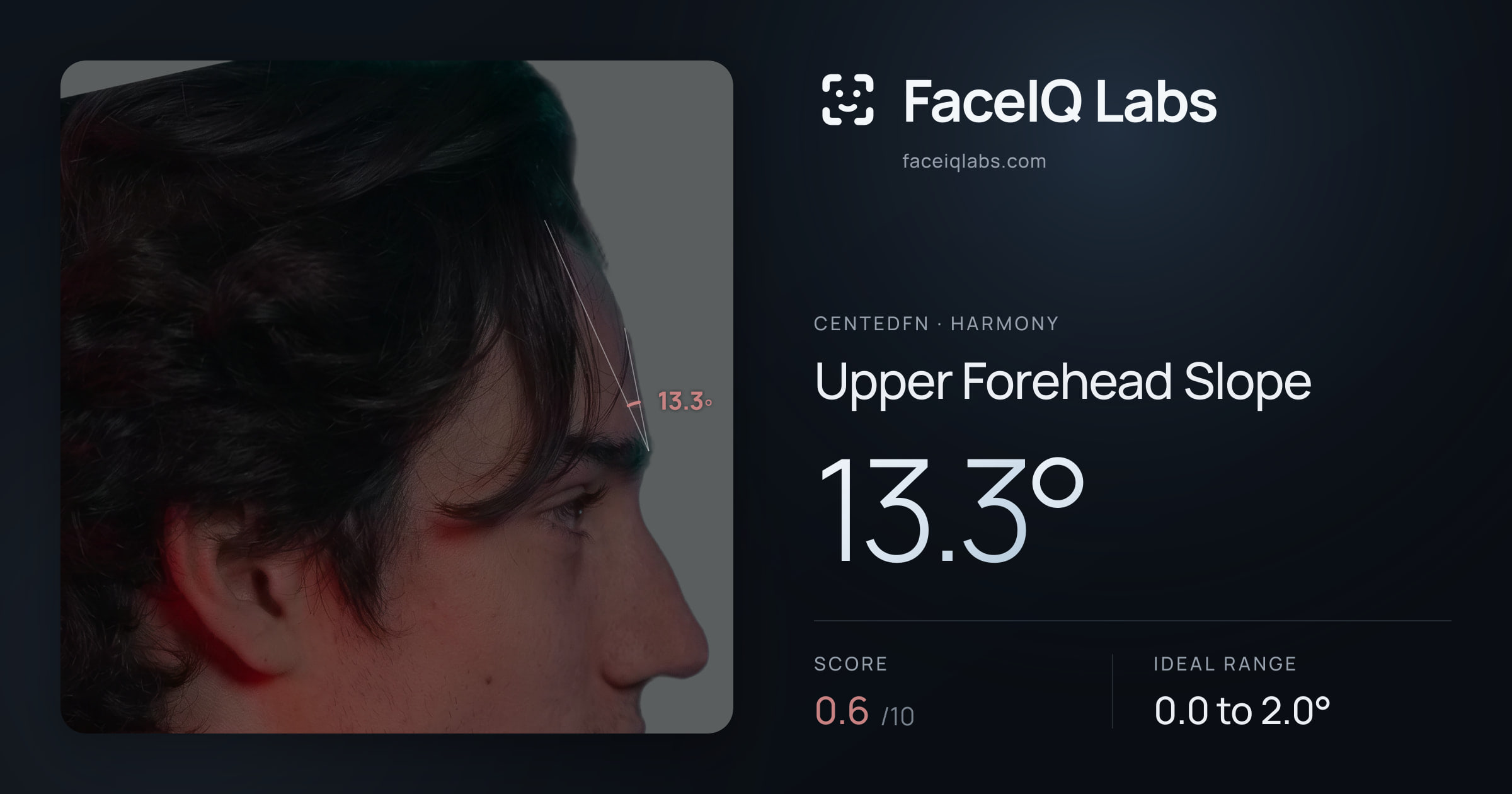 CentedFN Upper Forehead Slope: 13.3°, drawn on the photo