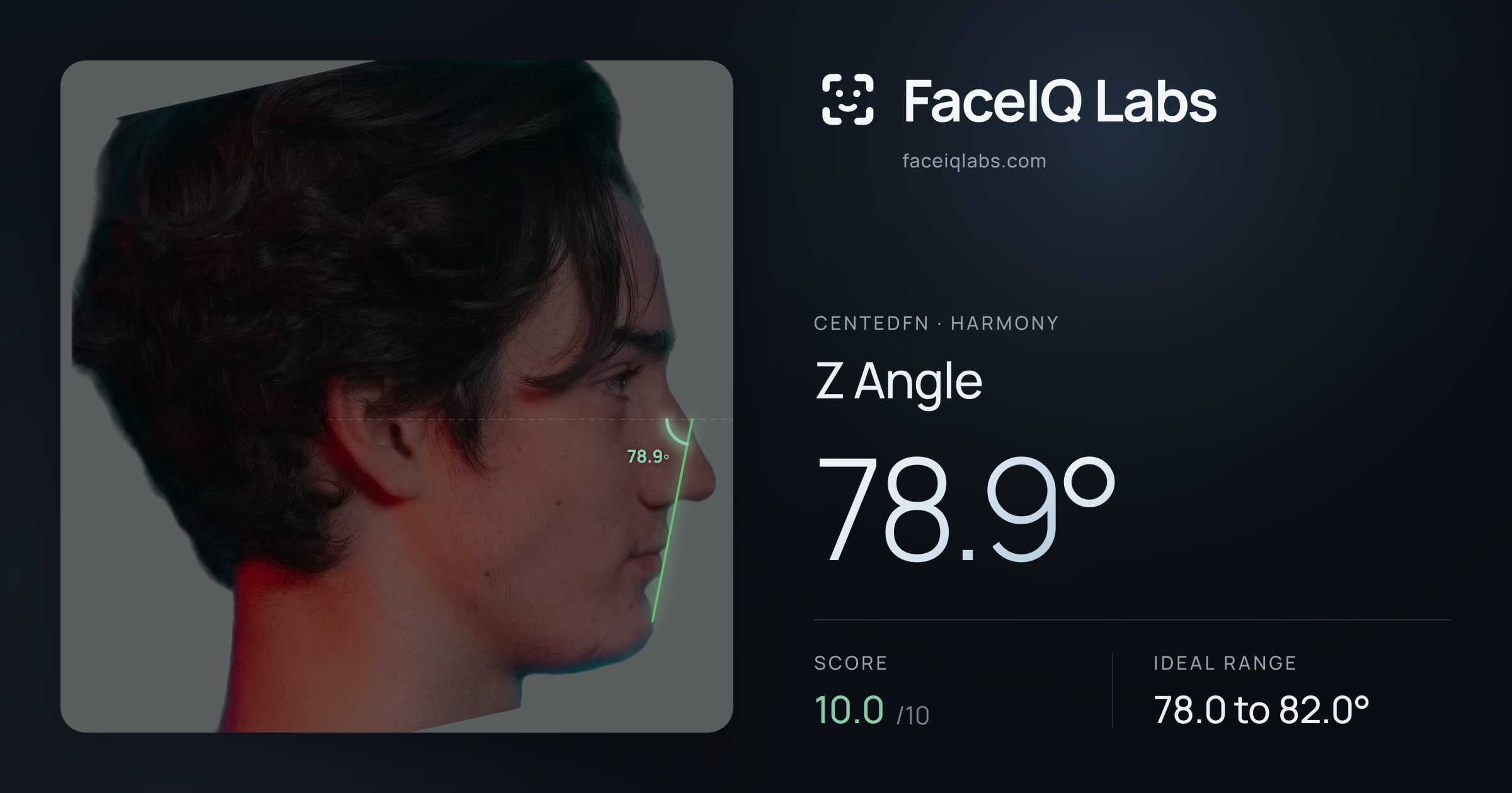 CentedFN Z Angle: 78.9°, drawn on the photo