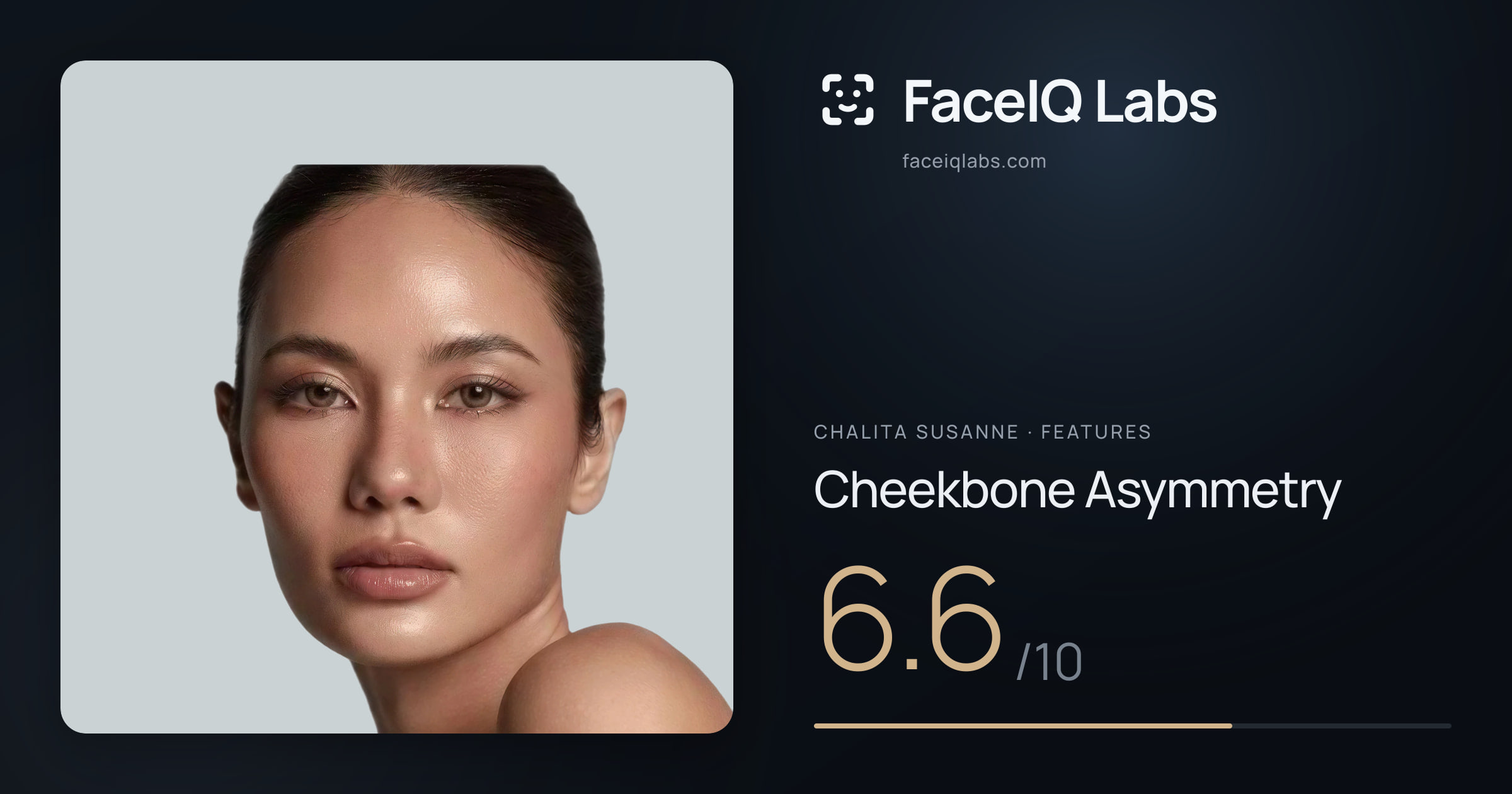 Chalita Susanne Cheekbone Asymmetry: 6.6/10, drawn on the photo