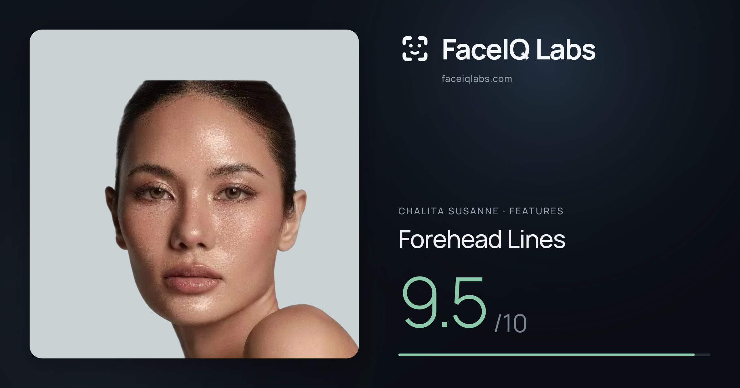Chalita Susanne Forehead Lines: 9.5/10, drawn on the photo